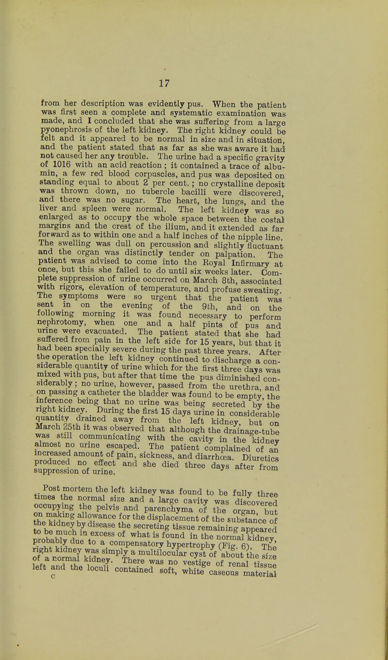 from her description was evidently pus. Wtien the patient was first seen a complete and systematic examination waa made, and I concluded that she was suffering from a large pyonephrosis ot the left kidney. The right kidney could be felt and it appeared to be normal in size and in situation, and the patient stated that as far as she was aware it had not caused her any trouble. The urine had a specific gravity of 1016 with an acid reaction ; it contained a trace of albu- min, a few red blood corpuscles, and pus was deposited on standing equal to about 2 per cent.; no crystalline deposit was thrown down, no tubercle bacilli were discovered, and there was no sugar. The heart, the lungs, and the liver and spleen were normal. The left kidney was so enlarged as to occupy the whole space between the costal margins and the crest of the ilium, and it extended as far forward as to within one and a half inches of the nipple line. The swelling was dull on percussion and slightly fluctuant and the organ was distinctly tender on palpation. The patient was advised to come into the Royal Infirmary at once, but this she failed to do until six weeks later. Com- plete suppression of urine occurred on March 8th, associated with rigors, elevation of temperature, and profuse sweating The symptoms were so urgent that the patient was sent in on the evening of the 9th. and on the following morning it was found necessary to perform nephrotomy, when one and a half pints of pus and nrme were evacuated. The patient stated that she had suffered from pain in the left side for 15 years, but that it had been specially severe during the past three years After the operation the left kidney continued to discharge a con- siderable quantity of urine which for the first three days was mixed with pus, but after that time the pus diminished con- siderably ; no urine, however, passed from the urethra and on passing a catheter the bladder was found to be empty the inference being that no urine was being secreted by the right kidney. _ During the first 15 days urine in considerable quantity drained away from the left kidney, but on March 25tb it was observed that although the drainage-tube was still communicating with the cavity in the kidney almost no urine escaped. The patient complained of an increased amount of pain, sickness, and diarrhea. Diuretics produced no effect and she died three days after from suppression of urine. t?5fo ¥^ ^^^^y fo^'i'i to be fully three times the normal size and a large cavity was discovered occupying the pelvis and parenchyma of the organ S on making allowance for the displacement of the suStance of the kidney by disease the secreting tissue remaining appeared to be much in excess of what is found in the norma? kidnev