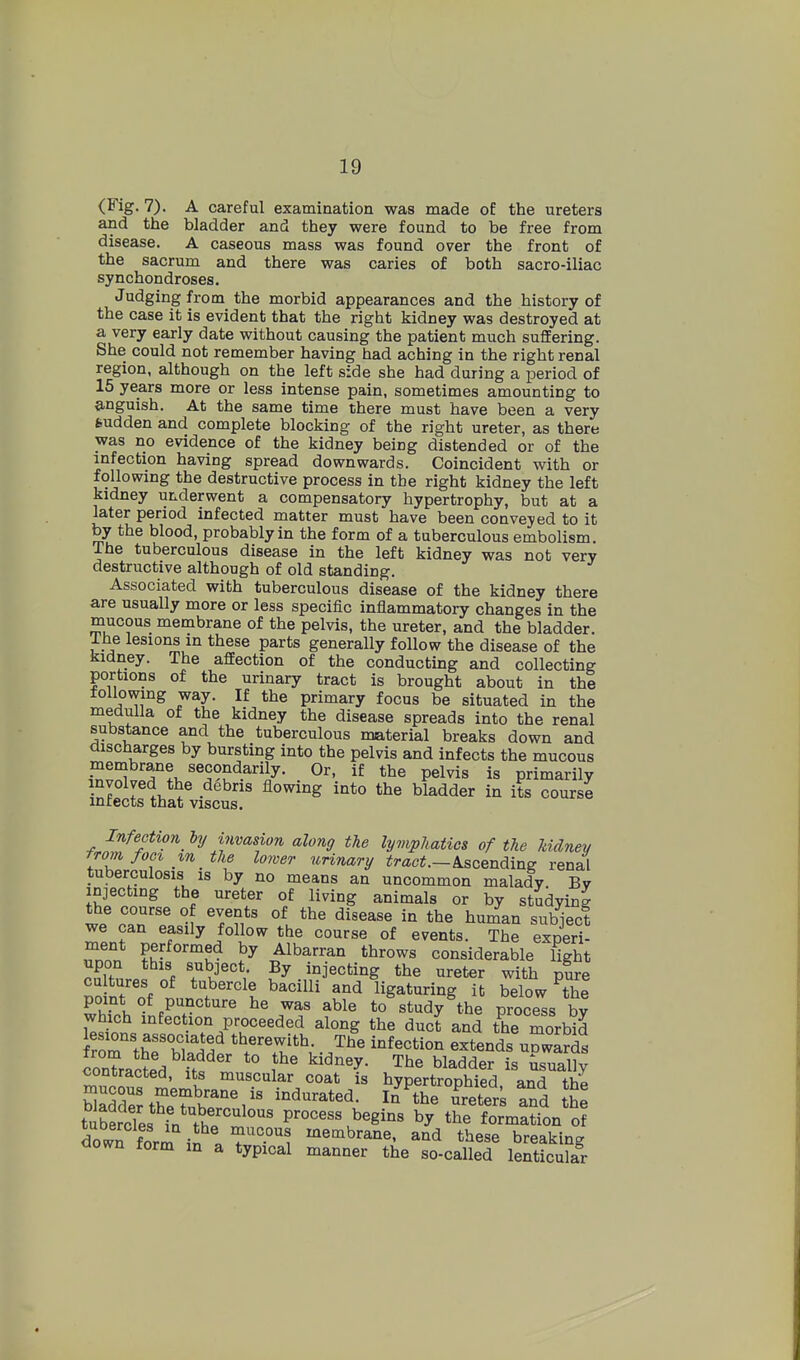 (Fig. 7). A careful examination was made of the ureters and the bladder and they were found to be free from disease. A caseous mass was found over the front of the sacrum and there was caries of both sacro-iliac synchondroses. Judging from the morbid appearances and the history of the case it is evident that the right kidney was destroyed at a very early date without causing the patient much suflEering. She could not remember having had aching in the right renal region, although on the left side she had during a period of 15 years more or less intense pain, sometimes amounting to anguish. At the same time there must have been a very sudden and complete blocking of the right ureter, as there was no evidence of the kidney being distended or of the infection having spread downwards. Coincident with or following the destructive process in the right kidney the left kidney underwent a compensatory hypertrophy, but at a later period infected matter must have been conveyed to it by the blood, probably in the form of a tuberculous embolism. The tuberculous disease in the left kidney was not very destructive although of old standing. Associated with tuberculous disease of the kidney there are usually more or less specific inflammatory changes in the mucous membrane of the pelvis, the ureter, and the bladder, ihe lesions in these parts generally follow the disease of the kidney. The affection of the conducting and collecting portions of the urinary tract is brought about in the tollowmg way. If the primary focus be situated in the medulla of the kidney the disease spreads into the renal substance and the tuberculous material breaks down and discharges by bursting into the pelvis and infects the mucous pelvis is primarily involved the debris flowing into the bladder in its course mrects that viscus. Infection hj invasion along the lymphatics of the Mdnev from foci in the lower uHnary tract.—kscendins renal tuberculosis is by no means an uncommon malady Bv injecting the ureter of living animals or by studying we can easily follow the course of events. The experi- ,?nnn P^f^^^^^^ ^y Albarran throws considerable light upon this subject By injecting the ureter with pure cu tures of tubercle bacilli and ligaturing it below ^the point of puncture he was able to study the process bv which infection proceeded along the duct and the morbM lesions associated therewith. The infection extends uowlrds conTracted ftf*° f^' ^^^^^^^ ^^^alTy contracted, its muscular coat is hypertrophied and ihi SS?twt^%'' In the Teters and th^ tuSs^V'?h^;^,^°' process begins by the formation o? down form in « membrane, and these breaking oown form m a typical manner the so-called lenticular