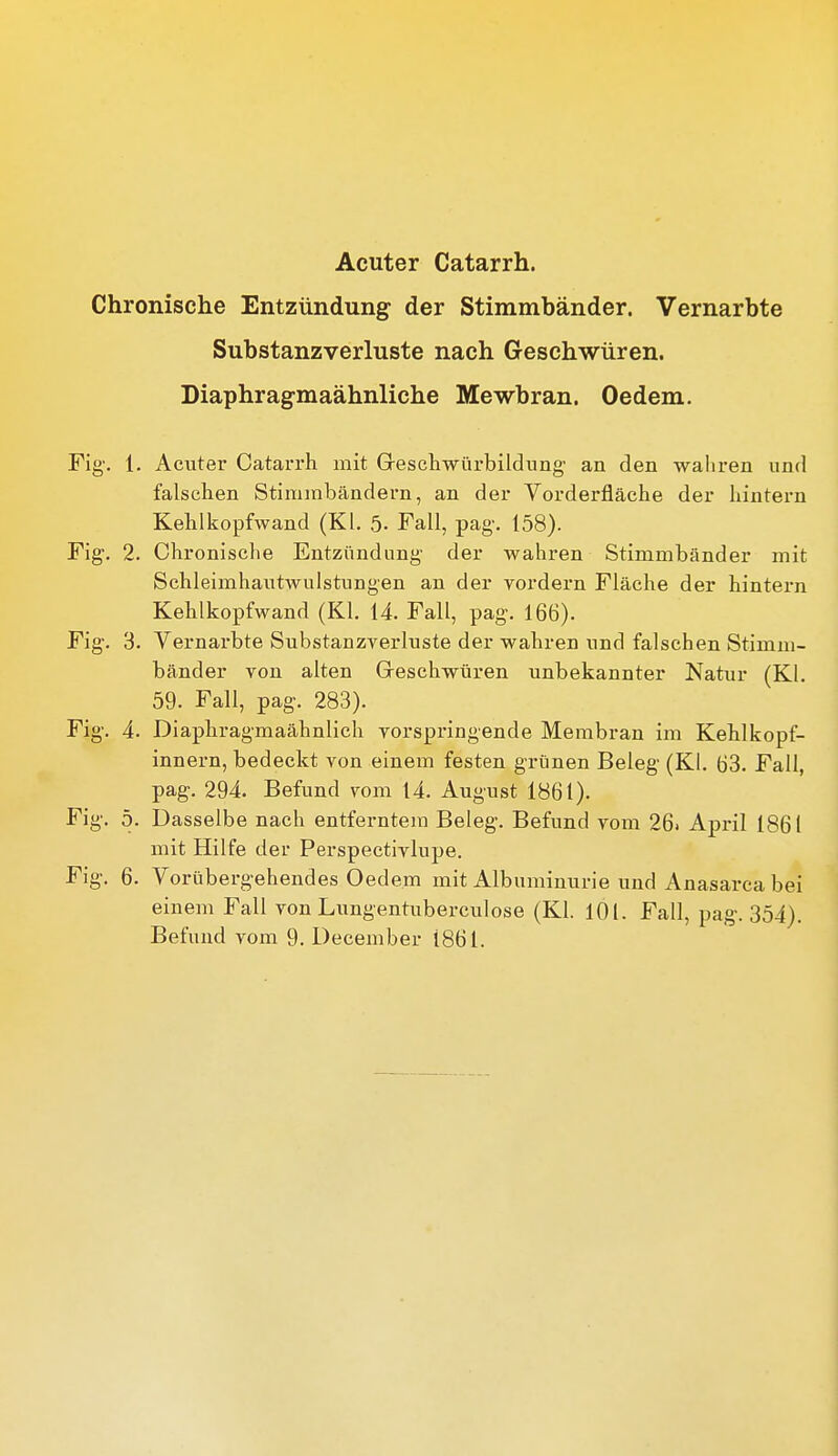 Acuter Catarrh. Chronische Entzündung der Stimmbänder. Vernarbte Substanzverluste nach Geschwüren. Diaphragmaähnliche Mewbran. Oedem. Fig'. 1. Acuter Catarrh mit Gescliwiirbildimg' an den wahren und falschen Stimmbändern, an der Vorderfläche der hintern Kehlkopfwand (Kl. 5- Fall, pag-. 158). Fig. 2. Chronische Entzündung der wahren Stimmbänder mit Schleimhautwulstungen an der yordern Fläche der hintern Kehlkopfwand (Kl. 14. Fall, pag. 166). Fig. 3. Vernarbte Substanzverluste der wahren und falschen Stimm- bänder von alten Greschwüren unbekannter Natur (Kl. 59. Fall, pag. 283). Fig'. 4. Diaphragmaähnlich vorspringende Membran im Kehlkopf- innern, bedeckt von einem festen grünen Beleg- (Kl. Ö3. Fall, pag. 294. Befund vom 14. August 1861). Fig. 5. Dasselbe nach entferntem Beleg-. Befund vom 26. April 1861 mit Hilfe der Perspectivlupe. Fig. 6. Vorübergehendes Oedem mit Albuminurie und Anasarca bei einem Fall von Lungentuberculose (Kl. 101. Fall, pag-. 354). Befund vom 9. December 1861.