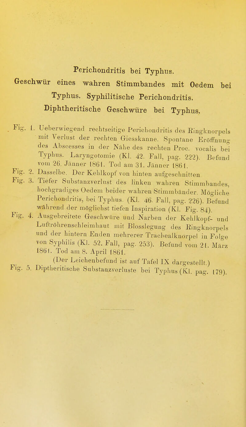 Perichondritis bei Typhus. Geschwür eines wahren Stimmbandes mit Oedem bei Typhus. Syphilitische Perichondritis. Diphtheritische Geschwüre bei Typhus. . Fi-. 1. Ueberwiegend reclitseitige Perichondritis des Eingknorpels ■ mit Verlust der rechten Giesskanne. Spontane Eröffnung des Abscesses in der Nähe des rechten Proc. vocalis be'i Typhus. Laryngotoniie (Kl. 42. Fall, pag. 222). Befund vom 26. Jänner 1861. Tod am 31. Jänner 1861. Fig. 2. Dasselbe. Der Kehlkopf von hinten aufgeschnitten Flg. 3. Tiefer Substanzverlust des linken wahren Stimmbandes, hochgradiges Oedem beider wahren Stimmbänder. Möglich^ Perichondritis, bei Typhus. (Kl. 46. Fall, pag. 226). Befund während der möglichst tiefen Inspiration (Kl. Fig. 84). Fig\ 4. Ausgebreitete Geschwüre und Narben der Kehlkopf- und Luftröhrenschleimhaut mit Blosslegung des Eingknorpels und der hintern Enden mehrerer Tracbealkuorpel in Folge von Syphilis (Kl. 52. Fall, pag. 253). Befund vom 21. Mä!-z 1861. Tod am 8. April 1861. (Der Leichenbefund ist auf Tafel IX dargestellt.)