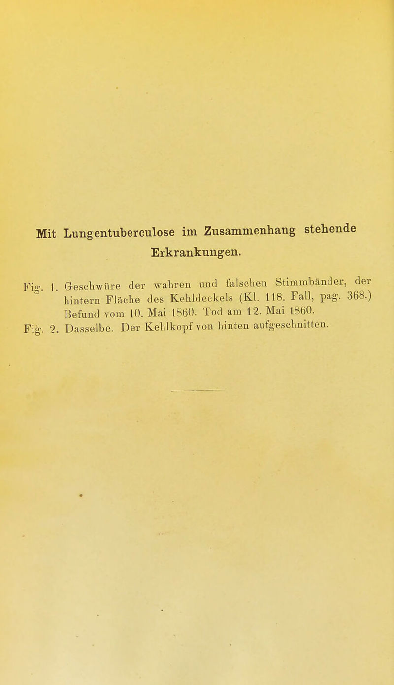 Erkrankungen. Fio' 1 Geschwüre der wahren und falschen Stimmbänder, der  hintern Fläche des Kehldeckels (Kl. 118. Fall, pag. 368.) Befund vom 10. Mai 1860. Tod am 12. Mai 1860.