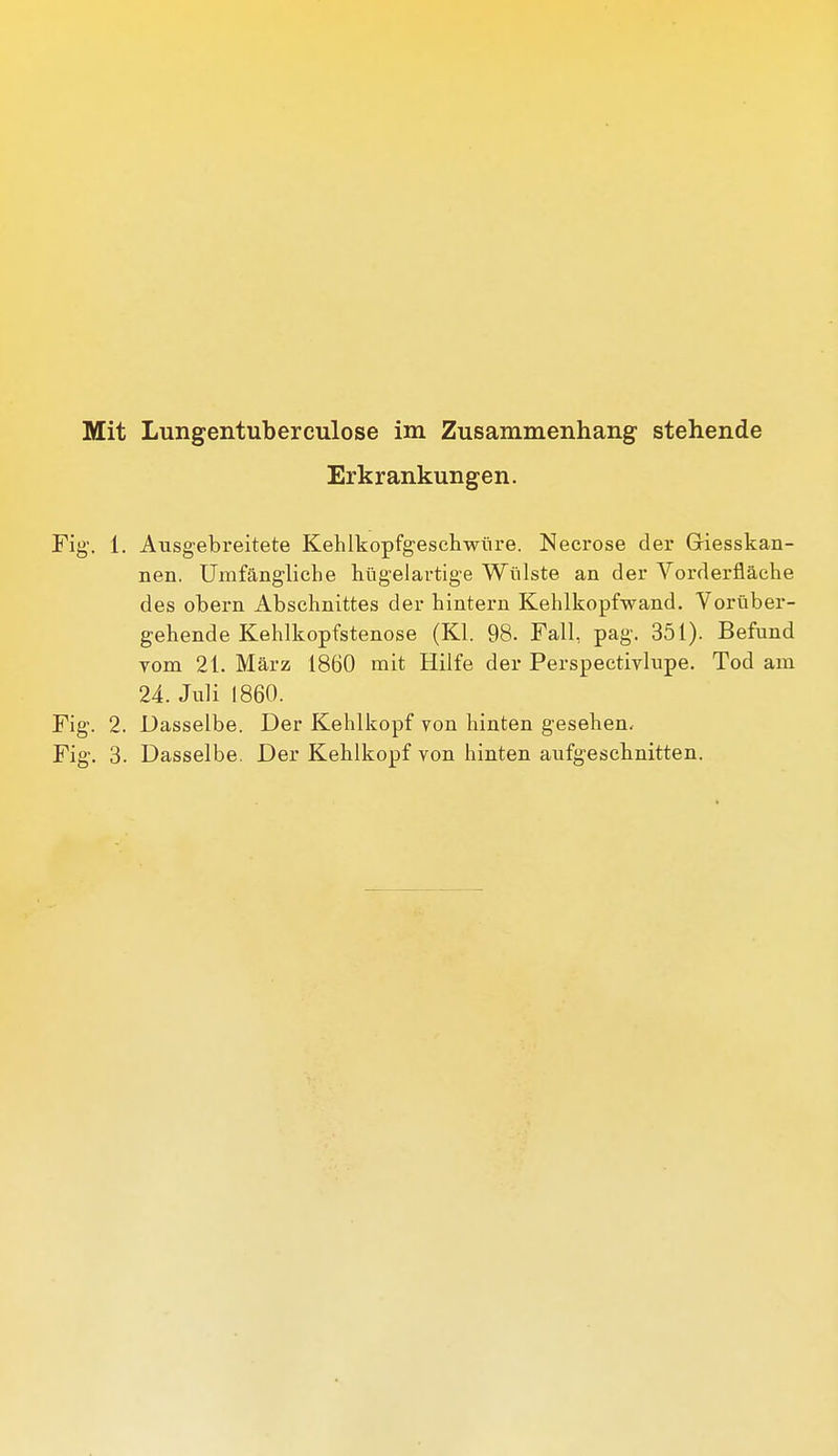 Erkrankungen. Fig. 1. Ausgebreitete Kehikopfgesehwüre. Necrose der Giesskan- nen. Umfängliche hügelartige Wülste an der Vorderfläche des obern Abschnittes der hintern Kehlkopfwand. Vorüber- gehende Kehlkopfstenose (Kl. 98. Fall, pag. 351). Befund vom 21. März 1860 mit Hilfe der Perspectivlupe. Tod am 24. Juli 1860. Fig. 2. Dasselbe. Der Kehlkopf von hinten gesehen. Fig. 3. Dasselbe. Der Kehlkopf von hinten aufgeschnitten.