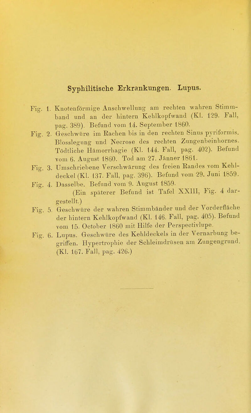 Syphilitische Erkrankungen. Lupus. Fig. 1. Knotenförmige Anseliwellung am rechten wahren Stimm- band und an der hintern Kehlkopfwand (Kl. 129. Fall, pag. 389). Befund Tom 14. September 1860. Fig. 2. Geschwüre im Rachen bis in den rechten Sinus pyriformis. Blosslegnng und Neerose des rechten Zungenbeinhornes. Tödtliche Hämorrhagie (Kl. 144. Fall, pag. 402). Befund Tom 6. August 1860. Tod am 27. Jänner 1861. Fig. 3. Umschriebene Verschwärung des freien Randes vom Kehl- deckel (Kl. 137. Fall, pag. 396). Befund vom 29. Juni 1859. Fig. 4. Dasselbe. Befund vom 9. August 1859- (Ein späterer Befund ist Tafel XXlll, Fig. 4 dar- gestellt.) Fig. 5. Greschwüre der wahren Stimmbänder und der Vorderfläche der hintern Kehlkopfwand (Kl. 146. Fall, pag. 405). Befund vom 15. October 1860 mit Hilfe der Perspectivlupe. Fig. 6. Lupus. Geschwüre des Kehldeckels in der Vernarbung be- griffen. Hypertrophie der Schleimdrüsen am Zungengrund. (Kl. 167. Fall, pag. 426.)