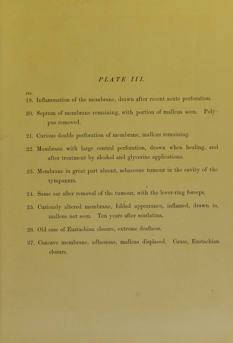 FIG. 19. Inflammation of the membrane, drawn after recent acute perforation. 20. Septum of membrane remaining, with portion of malleus seen. Poly- pus removed. 21. Curious double perforation of membrane, malleus remaining. 22. Membrane with large central perforation, drawn when healing, and after treatment by alcohol and glycerine applications. 23. Membrane in great part absent, sebaceous tumour in the cavity of the tympanum. 24. Same ear after removal of the tumour, with the lever-ring forceps. 25. Curiously altered membrane, folded appearance, inflamed, drawn in, malleus not seen. Ten years after scarlatina. 26. Old case of Eustachian closure, extreme deafness. 27. Concave membrane, adhesions, malleus displaced. Cause, Eustachian closure.