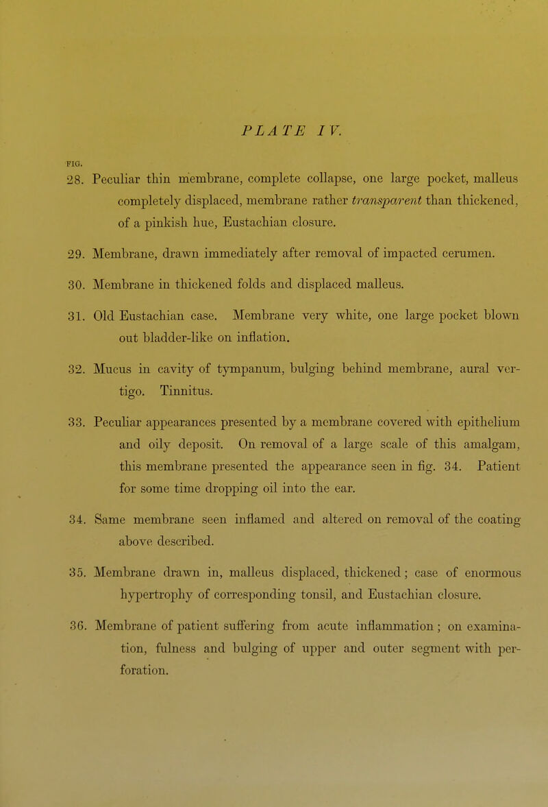 FIG. 28. Peculiar thin membrane, complete collapse, one large pocket, malleus completely displaced, membrane rather transparent than thickened, of a pinkish hue, Eustachian closure. 29. Membrane, drawn immediately after removal of impacted cerumen. 30. Membrane in thickened folds and displaced malleus. 31. Old Eustachian case. Membrane very white, one large pocket blown out bladder-like on inflation. 32. Mucus in cavity of tympanum, bulging behind membrane, aural ver- tigo. Tinnitus. 33. Peculiar appearances presented by a membrane covered with epithelium and oily deposit. On removal of a large scale of this amalgam, this membrane presented the appearance seen in fig. 34. Patient for some time dropping oil into the ear. 34. Same membrane seen inflamed and altered on removal of the coating above described. 35. Membrane drawn in, malleus displaced, thickened; case of enormous hypertrophy of corresponding tonsil, and Eustachian closure. 36. Membrane of patient suffering from acute inflammation; on examina- tion, fulness and bulging of upper and outer segment with per- foration.