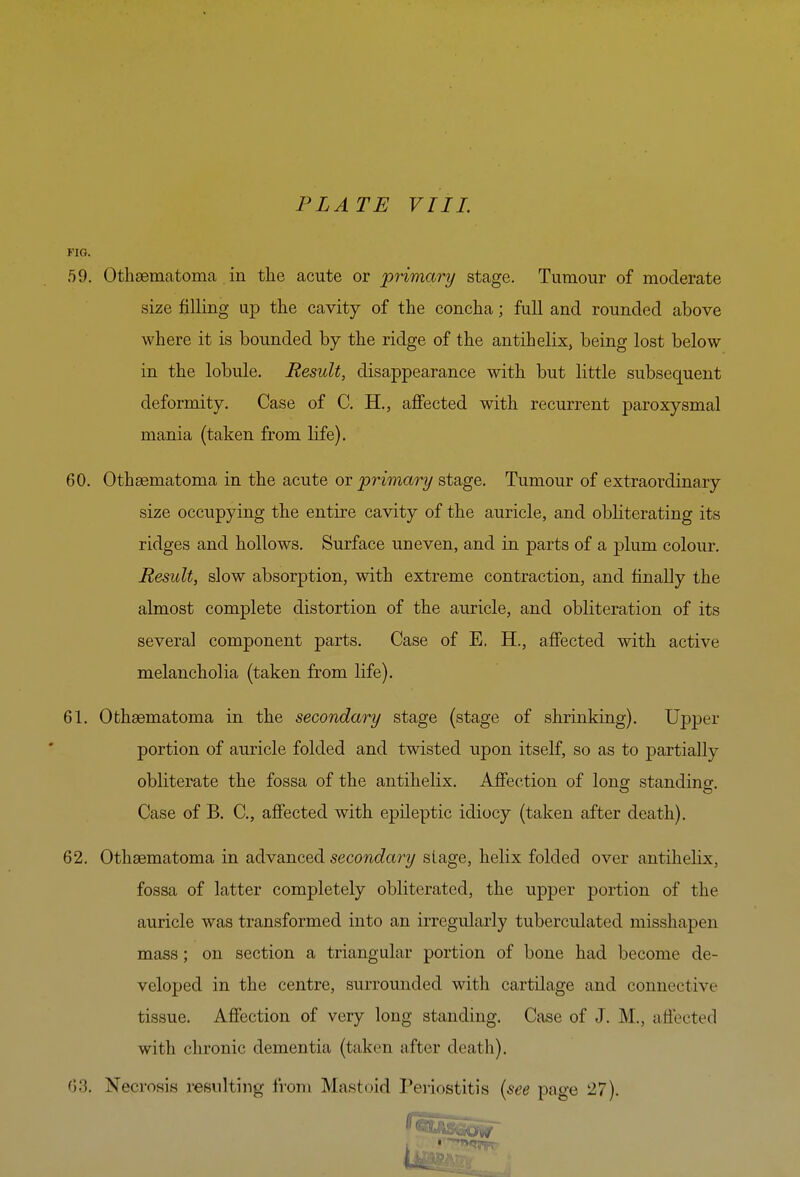 FIG. 59. Othfematoma . in tlie acute or pyimary stage. Tumour of moderate size filling up the cavity of the concha; full and rounded above where it is bounded by the ridge of the antihelix, being lost below in the lobule. Result, disappearance with but little subsequent deformity. Case of C. H,, affected with recurrent paroxysmal mania (taken from life). 60. Othsematoma in the acute or primary stage. Tumour of extraordinary size occupying the entire cavity of the auricle, and obliterating its ridges and hollows. Surface uneven, and in parts of a plum colour. Result, slow absorption, with extreme contraction, and finally the almost complete distortion of the auricle, and obliteration of its several component parts. Case of E. H., affected with active melancholia (taken from life). 61. Othaematoma in the secondary stage (stage of shrinking). Upper portion of auricle folded and twisted upon itself, so as to partially obliterate the fossa of the antihelix. Affection of long standing. Case of B. C, affected with epileptic idiocy (taken after death). 62. Othsematoma in advanced secondary stage, helix folded over antihelix, fossa of latter completely obliterated, the upper portion of the auricle was transformed into an irregularly tuberculated misshapen mass; on section a triangular portion of bone had become de- veloped in the centre, surrounded with cartilage and connective tissue. Affection of very long standing. Case of J. M., affected with chronic dementia (taken after death). 63. Necrosis resulting from Mastoid Periostitis (see page 27).
