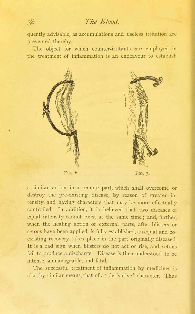 quently advisable, as accumulations and useless irritation are prevented thereby. The object for which counter-irritants are employed in the treatment of inflammation is an endeavour to establish Fig. 6. Fig. 7. a similar action in a remote part, which shall overcome or destroy the pre-existing disease, by reason of greater in- tensity, and having characters that may be more effectually controlled. In addition, it is believed that two diseases of equal intensity cannot exist at the same time; and, further, when the healing action of external parts, after blisters or setons have been applied, is fully established, an equal and co- existing recovery takes place in the part originally diseased. It is a bad sign when blisters do not act or rise, and setons fail to produce a discharge. Disease is then understood to be intense, unmanageable, and fatal. The successful treatment of inflammation by medicines is also, by similar means, that of a  derivative  character. Thus