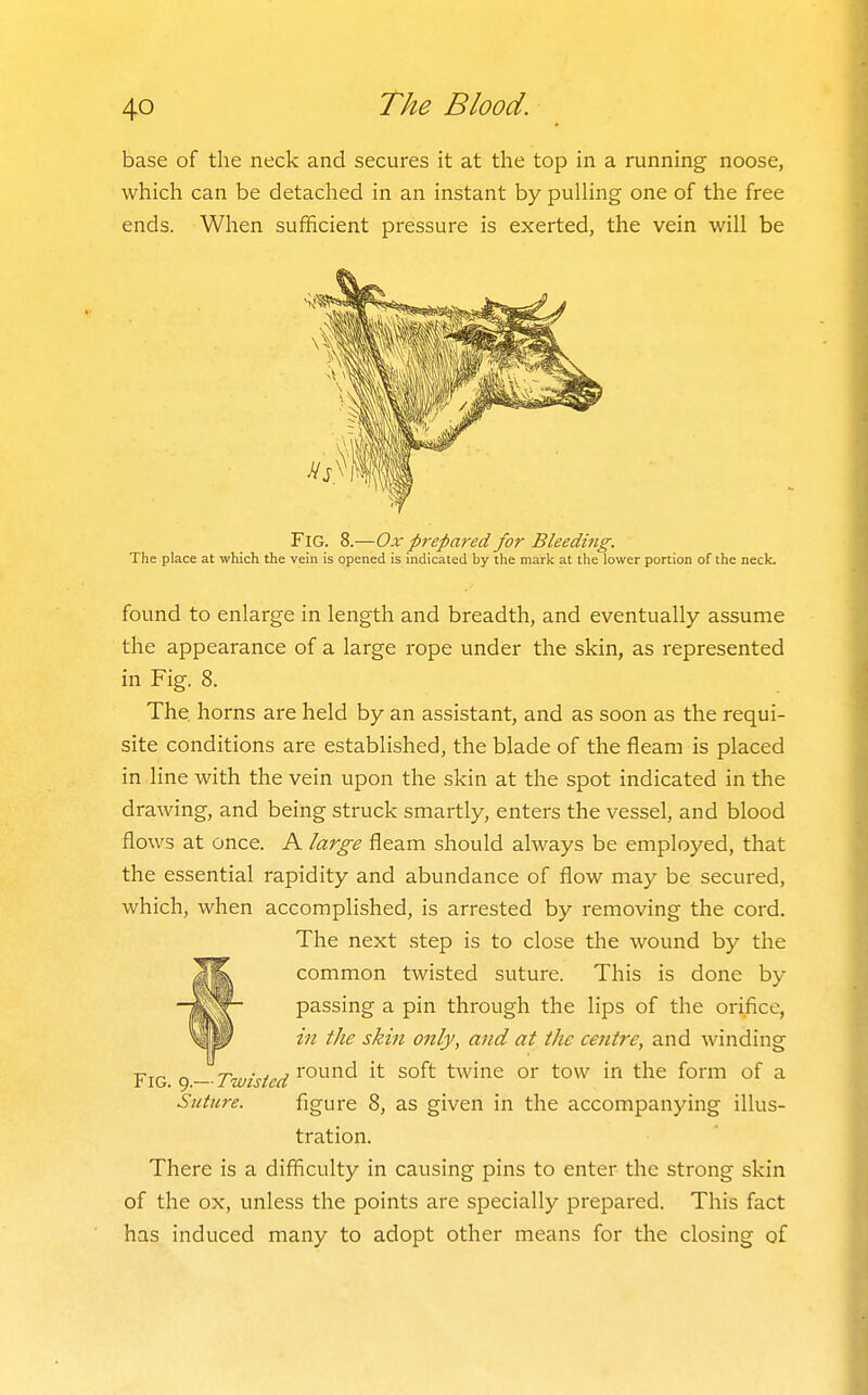 base of the neck and secures it at the top in a running noose, which can be detached in an instant by pulHng one of the free ends. When sufficient pressure is exerted, the vein will be Fig. 8.—Ox prepared for Bleeding. The place at which the vein is opened is indicated by the mark at the lower portion of the neck. found to enlarge in length and breadth, and eventually assume the appearance of a large rope under the skin, as represented in Fig. 8. The horns are held by an assistant, and as soon as the requi- site conditions are established, the blade of the fleam is placed in line with the vein upon the skin at the spot indicated in the drawing, and being struck smartly, enters the vessel, and blood flows at once. A large fleam should always be employed, that the essential rapidity and abundance of flow may be secured, which, when accomplished, is arrested by removing the cord. The next step is to close the wound by the fcommon twisted suture. This is done by passing a pin through the lips of the orifice, in the skin only, and at the centre, and winding Fig () —Twisted ^'^^^^^ twine or tow in the form of a Suture. figure 8, as given in the accompanying illus- tration. There is a difficulty in causing pins to enter the strong skin of the ox, unless the points are specially prepared. This fact has induced many to adopt other means for the closing of