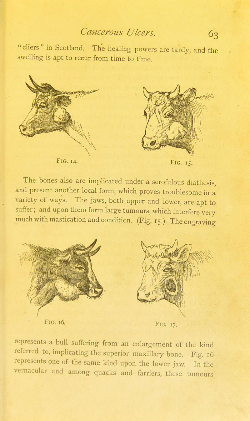  cliers  in Scotland. The healing powers are tardy, and the swelling is apt to recur from time to time. Fig. 14. Fig. 15 The bones also are implicated under a scrofulous diathesis, and present another local form, which proves troublesome in a variety of ways. The jaws, both upper and lower, are apt to suffer; and upon them form large tumours, which interfere very much with mastication and condition. (Fig. 15.) The engraving represents a bull suffering from an enlargement of the kind referred to, implicating the superior maxillary bone. Fig. 16 represents one of the same kind upon the lower jaw. In the vernacular and among quacks and farriers, these tumours