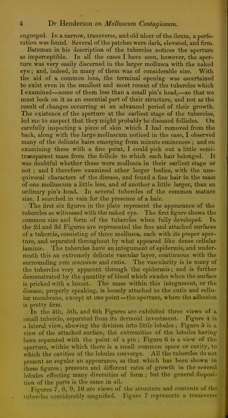 engorged. In a narrow, transverse, and old ulcer of the ileum, a perfo- ration was found. Several of the patches were dark, elevated, and firm. Bateman in his description of the tubercles notices the aperture as imperceptible. In all the cases I have seen, however, the aper- ture was very easily discerned in the larger mollusca with the naked eye ; and, indeed, in many of them was of considerable size. With the aid of a common lens, the terminal opening was ascertained to exist even in the smallest and most recent of the tubercles which I examined—some of thera less than a small pin's head,—so that we must look on it as an essential part of their structure, and not as the result of changes occurring at an advanced period of their growth. The existence of the aperture at the earliest stage of the tubercles, led me to suspect that they might probably be diseased follicles. On carefully inspecting a piece of skin which I had removed from the back, along with the large molluscum uoticed in the case, I observed many of the delicate hairs emerging from minute eminences ; and on examining these with a fine point, I could pick out a little semi- transparent mass from the follicle to which each hair belonged. It was doubtful whether these were mollusca in their earliest stage or not ; and I therefore examined other larger bodies, with the une- quivocal characters of the disease, and found a fine hair in the mass of one molluscum a little less, and of another a little larger, than an ordinary pin's head. In several tubercles of the common mature size, I searched in vain for the presence of a hair. The first six figures in the plate represent the appearance of the tubercles as witnessed with the naked eye. The first figure shows the common size and form of the tubercles when fully developed. In the 2d and 3d Figures are represented the free and attached surfaces of a tubercle, consisting of three mollusca, each with its proper aper- ture, and separated throughout by what appeared like dense cellular laminae. The tubercles have an integument of epidermis, and under- neath this an extremely delicate vascular layer, continuous with the surrounding rele vnicosum and cutis. The vascularity is in many of the tubercles very apparent through the epidermis; and is further demonstrated by the quantity of blood which exudes when the surface is pricked with a lancet. The mass within this integument, or the disease, properly speaking, is loosely attached to the cutis and cellu- lar membrane, except at one point—the apei'ture, where the adhesion is pretty firm. In the 4th, 5th, and 6th Figures are exhibited three views of a .small tubercle, separated from its dermoid investment. Figure 4- is ii lateral view, showing the division into little lobules ; Figure 5 is a view of the attached sui'face, the extremities of the lobules having been separated with the point of a pin ; Figure 6 is a view of the aperture, within which there is a small common space or cavity, (o which the cavities of the lobules converge. All the tubercles do not present so regular an appearance, as that which has been shown in these figures; pressure and different rates of growth in the several lobules effecting many diversities of form ; but the general disposi- tion of the parts is the same in all. Figures 7, 8, 9, 10 are views of the structure and contents of the tubercles considerably magnified. Figure 7 represents a transverse