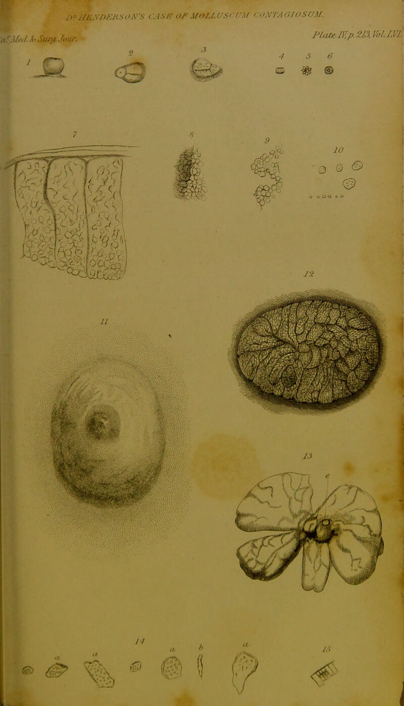 ■i/Vi's-'.V'v C.ISF or MOIJ.rscCM roNTAOlOSUM.