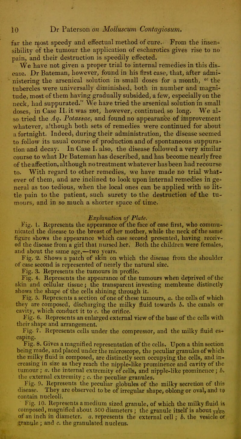 far the r^ost speedy and effectual method of cure. From the insen- sibility of the tumour the application of escharotics gives rise to no pain, and their destruction is speedily effected. We have not given a proper trial to internal remedies in this dis- ease. Dr Bateman, however, found in his first case, that, after admi- nistering the arsenical solution in small doses for a month,  the tubercles were universally diminished, both in number and magni- tude, most of them having gradually subsided, a few, especially on the neck, had suppurated. We have tried the arsenical solution in small doses, in Case II. it was not, however, continued so long. We al- so tried the Aq. Potassae, and found no appearance of improvement whatever, although both sets of remedies were continued for about a fortnight. Indeed^ during their administration, the disease seemed to follow its usual course of production and of spontaneous suppura- tion and decay. In Case I. also, the disease followed a very similar course to what Dr Bateman has described, and has become nearly free of the affection, although no treatment whatever has been had recourse to. With regard to other remedies, we have made no trial what- ever of them, and are inclined to look upon internal remedies in ge- neral as too tedious, when the local ones can be applied with so lit- tle pain to the patient, such surety to the destruction of the tu- mours, and in so much a shorter space of time. Explanation of Plate. Fig. I. Represents the appearance of the face of case first, who commu- nicated the disease to the breast of her mother, while the neck of the same figure shows the appearance which case second presented, having receiv- ed the disease from a girl that nursed her. Both the children were females, and about the same age,—two years. Fig. 2. Shows a patch of skin on which the disease from the shoulder of case second is represented of nearly the natural siee. Fig. 3. Represents the tumours in profile. Fig. 4. Represents the appearance of the tumours when deprived of the skin and cellular tissue; the transparent investing membrane distinctly shows the shape of the cells shining through it. Fig. 5. Represents a section of one of these tumours, a. the cells of which they are composed, discharging the milky fluid towards b. the canals or cavity, which conduct it to c. the orifice. Fig. 6. Represents an enlarged external view of the base of the cells with their shape and arrangement. Fig. 7. Represents cells under the compressor, and the milky fluid es* caping. Fig. 8. Gives a magnified representation of the cells. Upon a thin section being made, and placed under the microscope, the pecuUar granules of which the milky fluid is composed, are distinctly seen occupying the cells, and in- creasing in size as they reach the nipple-like prominence and cavity of the tumour; a. the internal extremity of cells, and nipple-likc prominence; A. the external extremity ; c. the peculiar granules. Fig. 9. Represents the peculiar globules of the milky secretion of this disease. They are observed to be or irregular shape, oblong or oval, and to contain nucleoli. Fig. 10. Represents a medium sized granule, of which the milky fluid is composed, magnified about 500 diameters ; the granule itself is about tcot of an inch in diameter, a. represents the external cell; b. the vesicle or granule ; and c. the granulated nucleus.