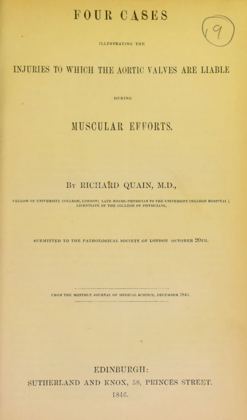 FOUR CASES ILLUSTKATlNd TUB INJURIES TO WHICH THE AORTIC VALVES ARE LIABLE MUSCULAR EFFORTS. Bv lilCUAllO QUAIN, M.D., Fei-I.OW OP UNIVKRSITV COLLEOE, LO.NDOX; I.ATE HOUSE-PHYSICIAN TO THE UNIVERSITY COLLEGE HOSPITAI LICENTIATE OF THE COLLEOE OF PHYSICIAN'S. srBMITTED TO THE PATHOLOGICAL SOCIETY Ol' LONDON OCTOBER 20t]I. I HOM THE MONTHLY JOUBN.iL OF MF.DICAL B( lENCK, nF.CEMnEB 184li. EDINBURGH: .SUTHERLAND AND KNOX, Oft, PRINCES STREET. 18-lG.