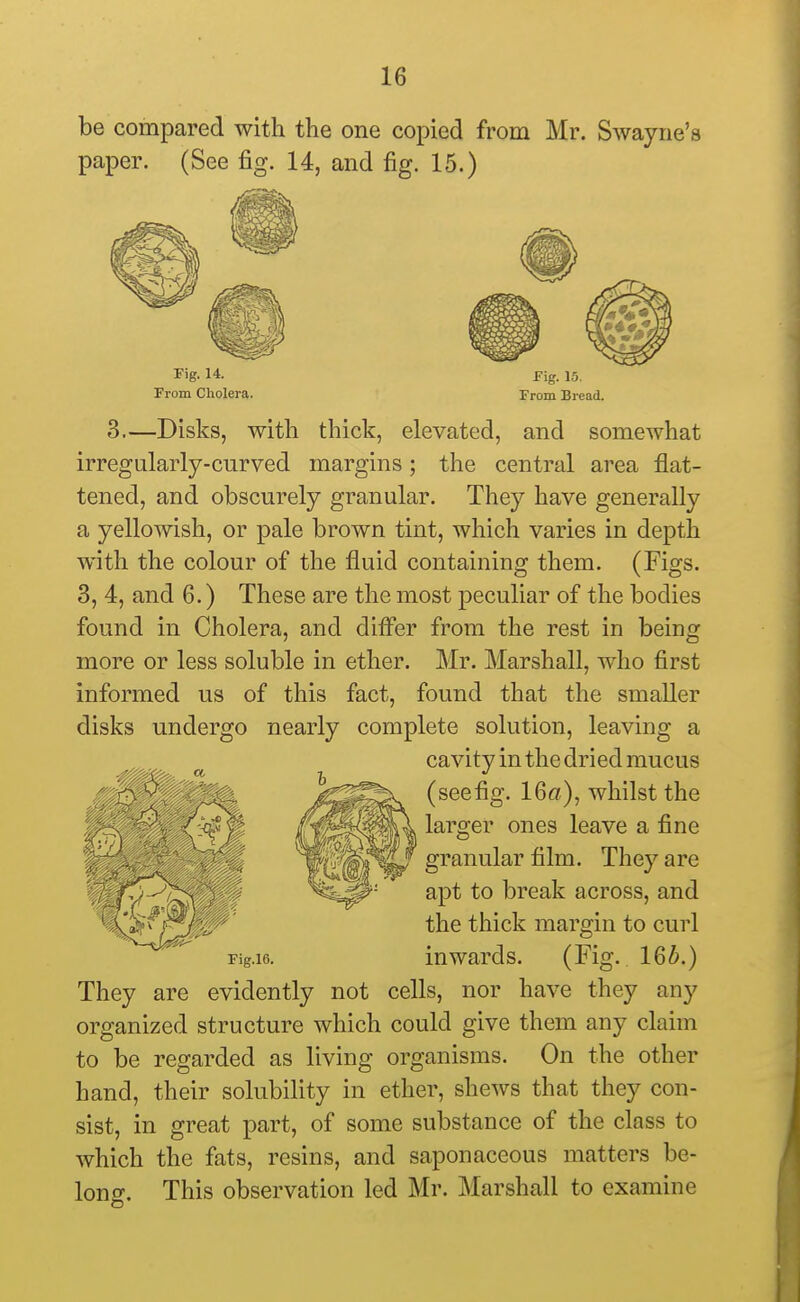 be compared with the one copied from Mr. Swayrie's paper. (See fig. 14, and fig. 15.) Fig. 14. From Cholera. Fig. 15. From Bread. 3.—Disks, with thick, elevated, and somewhat irregularly-curved margins; the central area flat- tened, and obscurely granular. They have generally a yellowish, or pale brown tint, which varies in depth with the colour of the fluid containing them. (Figs. 3, 4, and 6.) These are the most peculiar of the bodies found in Cholera, and difl*er from the rest in being more or less soluble in ether. Mr. Marshall, who first informed us of this fact, found that the smaller disks undergo nearly complete solution, leaving a cavity in the dried mucus (seefig. 16«), whilst the larger ones leave a fine granular film. They are apt to break across, and the thick margin to curl Fig.16. inwards. (Fig. 166.) They are evidently not cells, nor have they any organized structure which could give them any claim to be regarded as living organisms. On the other hand, their solubility in ether, shews that they con- sist, in great part, of some substance of the class to which the fats, resins, and saponaceous matters be- long. This observation led Mr. Marshall to examine