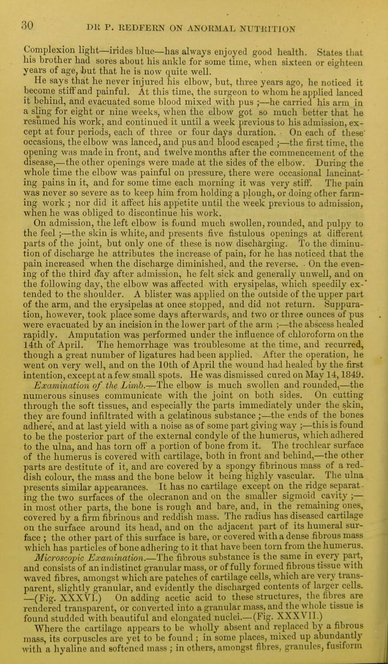 Complexion light—irides blue—has always enjoyed good health. States tliat his brother had sores about his ankle for some time, when sixteen or eighteen years of age, Jbut that he is now quite well. He says that he never injured his elbow, but, three years ago, he noticed it become stiff and painful. At this time, the surgeon to whom he applied lanced it behind, and evacuated some blood mixed with i)us ;—he carried his arm in a sling for eight or nine weeks, when the elbow got so much better that he resumed his work, and continued it until a week previous to his admission, ex- cept at four periods, each of three or four days duration. On each of these' occasions, the elbow was lanced, and pus and blood escaped ;—the first time, the opening was made in front, and twelve months after the commencement of the disease,—the other openings were made at the sides of the elbow. During the whole time the elbow was painful on pressure, there were occasional lancinat- ing pains in it, and for some time each morning it was very stiff. The pain was never so severe as to keep him from holding a plough, or doing other farm- ing work ; nor did it affect his appetite until the week previous to admission, when he was obliged to discontinue his work. On admission, the left elbow is found much swollen, rounded, and pulpy to the feel ;—the skin is white, and presents five fistulous openings at different parts of the joint, but only one of these is now discharging. To the diminu- tion of discharge he attributes the increase of pain, for he has noticed that the pain increased when the discharge diminished, and the reverse. ■ On the even- ing of the third day after admission, he felt sick and generally uuweU, and on the following day, the elbow was affected with erysipelas, which speedily ex- tended to the shoulder. A blister was applied on the outside of the upper part of the arm, and the erysipelas at once stopped, and did not return. Suppura- tion, however, took place some days afterwards, and two or three ounces of pus were evacuated by an incision in the lower part of the arm ;—the abscess healed rapidly. Amputation was performed under the influence of chloroform on the 14th of April. The hemorrhage was troublesome at the time, and recurred, though a great number of ligatures had been applied. After tiie operation, he went on very well, and on the 10th of April the wound had healed by the first intention, except at a few small spots. He was dismissed cured on May 14,1849. Examination of the Limb.—The elbow is much swollen and rounded,—the numerous sinuses communicate with the joint on both sides. On cutting through the soft tissues, and especially the parts immediately under the skin, they are found infiltrated with a gelatinous substance ;—tlie ends of the bones adhere, and at last yield with a noise as of some part giving way ;—this is found to be the posterior part of the external condyle of the humerus, which adhered to the ulna, and has torn off a portion of bone from it. The trochlear surface of the humerus is covered with cartilage, both in front and behind,—the other parts are destitute of it, and are covered by a spongy fibrinous mass of a red- dish colour, the mass and the bone below it being highly vascular. The ulna presents similar appearances. It has no cartilage except on the ridge separat - ing the two surfaces of the olecranon and on the smaller sigmoid cavity ;— in most other parts, the bone is rough and bare, and, in the remaining ones, covered by a firm fibrinous and reddish mass. The radius has diseased cartilage on the surface around its head, and on the adjacent part of its humeral sur- face ; the other part of this surface is bare, or covered with a dense fibrous mass which has particles of bone adhering to it that have been torn from the humerus. Microscopic Examination.—The fibrous substance is tlie same in every part, and consists of an indistinct granular mass, or of fully formed fibrous tissue with waved fibres, amongst which are patches of cartilage cells, which are very trans- parent, slightly granular, and evidently the discharged contents of larger cells. —(Fig. XXXVI.) On adding acetic acid to these structures, the fibres are rendered transparent, or converted into a granular mass, and the whole tissue is found studded with beautiful and elongated nuclei.—(Fig. XXXYII.) Where the cartilage appears to be wholly absent and replaced by a fibrous mass, its corpuscles are yet to be found ; in some places, mixed up abundantly with a hyaline and softened mass ; in others, amongst fibres, granules, fusiform