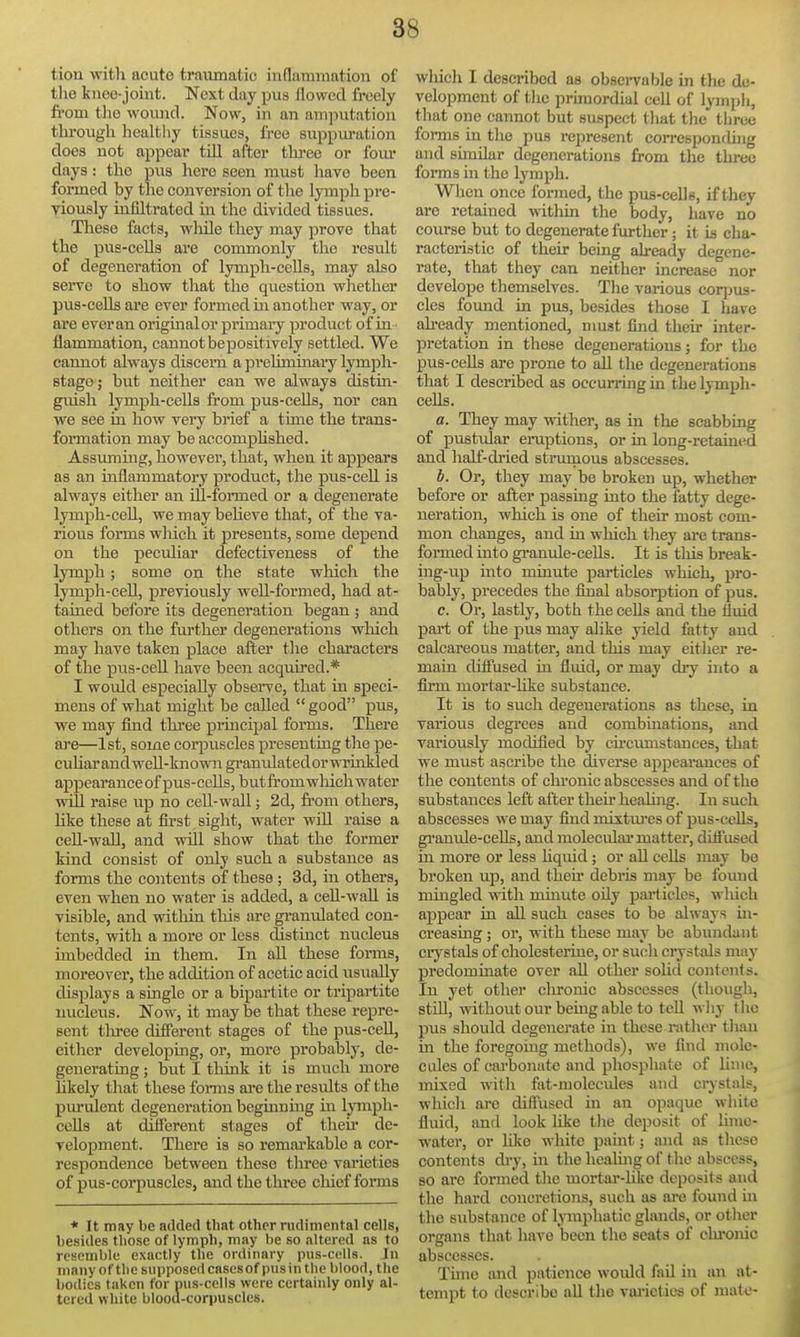 tion with acuto traumatic inflaramation of tlie knee-joint. Next day pus flowed freely fi'oni the wound. Now, in an amputation through healthy tissues, free suppm-ation does not appear till after tlu'ee or four days: the pus here seen must have been formed by the conversion of tlie lymph pre- viously infiltrated in the divided tissues. These facts, wliile they may prove that the pus-cells are commonly the result of degeneration of lymph-cells, may also serve to show that the question whether pus-cells are ever formed m another way, or are everan origmalor primary product of in flammation, cannot be positively settled. We cannot always discern a preliminary lymph- stago; but neither can we always distin- guish lymph-cells fi-om pus-ceUs, nor can we see in how very brief a time the trans- formation may beaccomphshed. Assuming, however, that, when it appears as an inflammatory product, the pus-cell is always either an ill-formed or a degenerate lymph-ceU., wemaybeUeve that, of the va- rious forms which it presents, some depend on the peculiar defectiveness of the lymph; some on the state which the lymph-cell, previously well-formed, had at- tained beibre its degeneration began ; and others on the further degenerations wliich may have taken place after the characters of the pus-cell have been acquired.* I would especially observe, that in speci- mens of what might be called  good pus, we may find thi'ee prmcipal forms. There are—1st, some corpviscles presenting the pe- cuhar and weU-knovm granulated or wruxkled appearance of pus-cells, but from which water will raise up no cell-wall; 2d, fi-om others, hke these at first sight, water will raise a ceU-wall, and will show that the former kind consist of only such a substance as forms the contents of these ; 3d, in others, even when no water is added, a cell-wall is visible, and within this are gi-anulated con- tents, with a more or less distinct nucleus imbedded in them. In all these forms, moreover, the addition of acetic acid visually displays a single or a bipartite or tripartite nucleus. Now, it may be that these repre- sent tliree diSerent stages of the pus-ceU, either developing, or, more probably, de- generating ; but I thmk it is much more hkely that these forms are the results of the purulent degeneration beginning in lymph- cells at different stages of then* de- velopment. There is so remarkable a cor- respondence between these three varieties of pus-corpuscles, and the three chief forms * It may be added that other rudimental cells, besides those of lymph, may be so altered as to resemble exactly the ordinary pus-cells. In many of the supposed cases of pus in the blood, the bodies taken for pus-cells were certainly only al- tered white bloou-corpuscles. wliich I described as obsei-vable in the de- velopment of the prbnordial cell of lymph, that one cannot but suspect that the three forms in the pus represent correspondhig and similar degenerations from the three forms in the lymph. Wlien once formed, the puB-eells, if they are retained witliui the body, have no course but to degenerate further; it b cha- racteristic of their being already degene- rate, that they can neither increase nor develope tliemselves. The various coq^us- cles found in pus, besides those I have ah-eady mentioned, must find their inter- pretation in these degenerations; for the pus-cells are prone to aU the degenerations that I described as occurring in the lymph- cells. a. They may wither, as in the scabbing of pustular eruptions, or in long-retained and half-dried strumous abscesses. b. Or, they may be broken up, whether before or after passing into the fatty dege- neration, which is one of their most com- mon changes, and in which they are trans- foi'med into granule-cells. It is tliis break- ing-up into minute particles which, pro- bably, precedes the final absorption of pus. c. Or, lastly, both the cells and the fluid part of the pus may alike yield fatty and calcareous matter, and this may either re- main diffused in fluid, or may dry into a fiirm mortar-hke substance. It is to such degenerations as these, in various degrees and combinations, and variously modified by ch'cumstanees, that we must ascribe the diverse appearances of the contents of chronic abscesses and of the substances left after their healuig. In such abscesses we may find mixtiu-es of jDus-ceUs, granule-cells, and moleculai'matter, diffused in more or less hqiiid; or all ccUs may be broken up, and then* debris may be found mingled with minute oily particles, wliich appear in all such cases to be always m- creasing ; or, with these may be abundant crystals of cholesterine, or such ci-ystals may predominate over all other solid contents. In yet other clironic abscesses (though, stiLl, without our bemgable to teU why the pus should degenerate in these rather tlian in the foregoing methods), we find mole- cules of carbonate and phosphate of lime, mixed wtli fat-molecules and crj-stals, wlucli are diffused in an opaque white fluid, and look like tlie deposit of lime- water, or like white paint; and as these contents di-y, ui the heahng of the abscess, so are formed tlie mortar-Uke deposits and the hard concretions, such as are found m the substance of lymphatic glands, or other organs that have been the seats of clironic abscesses. Tune and patience would fail in an at- tempt to describe all the varieties of mate-