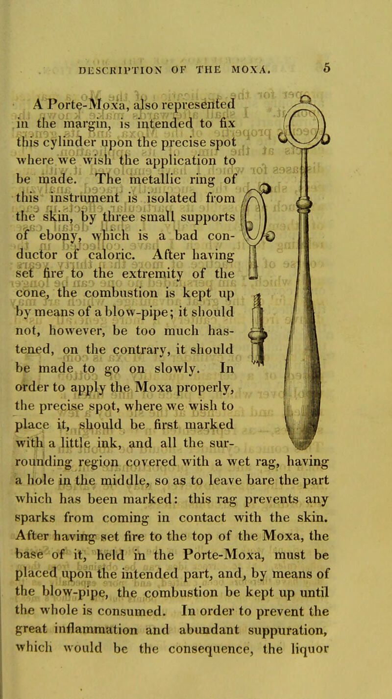 A Porte-Moxa, ajso represented in the margin, is intended to fix this cylinder upon the precise spot j^^ where we wish the application to ^ . , , ' 101 be made. The rnetallic ring of this instrument is isolated from the' skinj by three small supports | of ebony, Mhich is a bad con- ductor of caloric. After having set fire to the extremity of the cone, the combustion is kept up by means of a blow-pipe; it should not, however, be too much has- tened, on the contrary, it should be made to go on slowly. In oi-der to apply the Moxa properly, the precise spot, where we wish to place it, should be first marked with a little ink, and all the sur- rounding region covered with a wet rag, having :'a hole in the middle, so as to leave bare the part which has been marked: this rag prevents any sparks from coming in contact with the skin. After having set fire to the top of the Moxa, the Mfeie'^af it; held in the Porte-Moxa, must be placed upoii the intended part, and, by means of the blow-pipe, the combustion be kept up until the whole is consumed. In order to prevent the great inflammation and abundant suppuration, which would be the consequence, the liquor