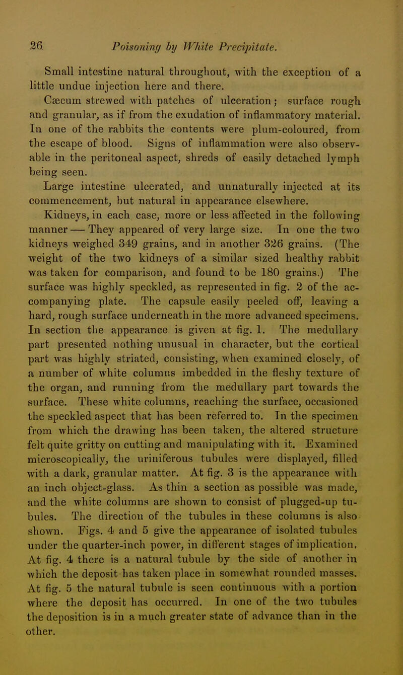 Small intestine natural throughout, with the exception of a little undue injection here and there. Caecum strewed with patches of ulceration; surface rough and granular, as if from the exudation of inflammatory material. In one of the rabbits the contents were plum-coloured, from the escape of blood. Signs of inflammation were also observ- able in the peritoneal aspect, shreds of easily detached l^^mph being seen. Large intestine ulcerated, and unnaturally injected at its commencement, but natural in appearance elsewhere. Kidneys, in each case, more or less affected in the following manner — They appeared of very large size. In one the two kidneys weighed 349 grains, and in another 326 grains. (The weight of the two kidneys of a similar sized healthy rabbit was taken for comparison, and found to be 180 grains.) The surface was highly speckled, as represented in fig. 3 of the ac- companying plate. The capsule easily peeled off*, leaving a hard, rough surface underneath in the more advanced specimens. In section the appearance is given at fig. 1. The medullary part presented nothing unusual in character, but the cortical part was highly striated, consisting, when examined closely, of a number of white columns imbedded in the fleshy texture of the organ, and running from the medullary part towards the surface. These white columns, reaching the surface, occasioned the speckled aspect that has been referred to. In the specimen from which the drawing has been taken, the altered structure felt quite gritty on cutting and manipulating with it. Examined microscopically, the uriniferous tubules were displayed, filled with a dark, granular matter. At fig. 3 is the appearance with an inch object-glass. As thin a section as possible was made, and the white columns are shown to consist of plugged-up tu- bules. The direction of the tubules in these columns is also shown. Figs. 4 and 5 give the appearance of isolated tubules under the quarter-inch power, in different stages of implication. At fig. 4 there is a natural tubule by the side of another in which the deposit has taken place in somewhat rounded masses. At fig. 5 the natural tubule is seen continuous with a portion where the deposit has occurred. In one of the two tubules the deposition is in a much greater state of advance than in the other.
