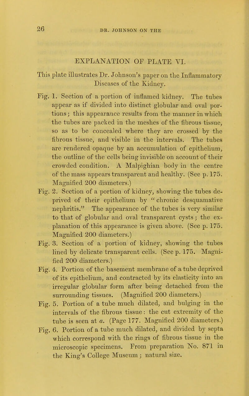 86 EXPLANATION OF PLATE VI. This plate illustrates Dr. Johnson's paper on the Inflammatoiy Diseases of the Kidney. Fig. 1. Section of a portion of inflamed kidney. The tubes appear as if divided into distinct globular and oval por- tions ; this appearance results from the manner in which the tubes are packed in the meshes of the fibrous tissue, so as to be concealed where they are crossed by the fibrous tissue, and visible in the intervals. The tubes are rendered opaque by an accumulation of epithelium, the outline of the cells being invisible on account of their crowded condition. A Malpighian body in the centre of the mass appears transparent and healthy. (See p. 175. Magnified 200 diameters.) Fig. 2. Section of a portion of kidney, showing the tubes de- prived of their epithelium by  chronic desquamative nephritis. The appearance of the tubes is very similar to that of globular and oval transparent cysts; the ex- planation of this appearance is given above. (See p. 175. Magnified 200 diameters.) Fig. 3. Section of a portion of kidney, showing the tubes lined by delicate transparent cells. (Seep. 175. Magni- fied 200 diameters.) Fig. 4. Portion of the basement membrane of a tube deprived of its epithelium, and contracted by its elasticity into an irregular globular form after being detached from the surrounding tissues. (Magnified 200 diameters.) Fig. 5. Portion of a tube much dilated, and bulging in the intervals of the fibrous tissue: the cut extremity of the tube is seen at a. (Page 177. Magnified 200 diameters.) Fig. 6. Portion of a tube much dilated, and divided by septa which correspond with the rings of fibrous tissue in the microscopic specimens. From preparation No. 871 in the King's College Museum; natural size.