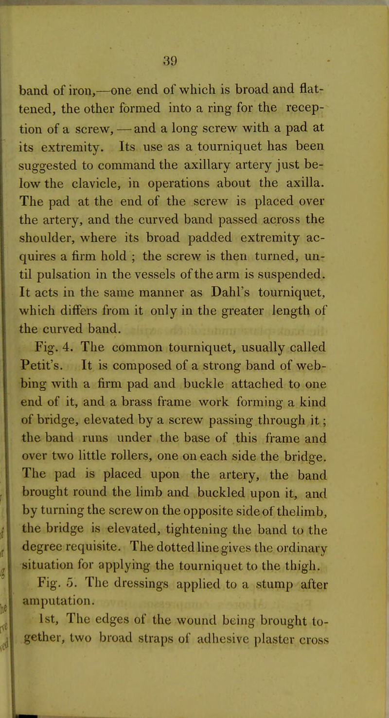 band of iron,—one end of which is broad and flat- tened, the other formed into a ring for the recep- tion of a screw, — and a long screw with a pad at its extremity. Its use as a tourniquet has been suggested to command the axillary artery just be- low the clavicle, in operations about the axilla. The pad at the end of the screw is placed over the artery, and the curved band passed across the shoulder, where its broad padded extremity ac- quires a firm hold ; the screw is then turned, un- til pulsation in the vessels of the arm is suspended. It acts in the same manner as Dahl's tourniquet, which differs from it only in the greater length of the curved band. Fig. 4. The common tourniquet, usually called Petit's. It is composed of a strong band of web- bing with a firm pad and buckle attached to one end of it, and a brass frame work forming a kind of bridge, elevated by a screw passing through it; the band runs under the base of this frame and over two little rollers, one on each side the bridge. The pad is placed upon the artery, the band brought round the limb and buckled upon it, and by turning the screw on the opposite side of thelimb, the bridge is elevated, tightening the band to the degree requisite. The dotted line gives the ordinary situation for applying the tourniquet to the thigh. Fig, 5. The dressings applied to a stump after amputation. 1st, The edges of the wound being brought to- gether, two broad straps of adhesive plaster cross