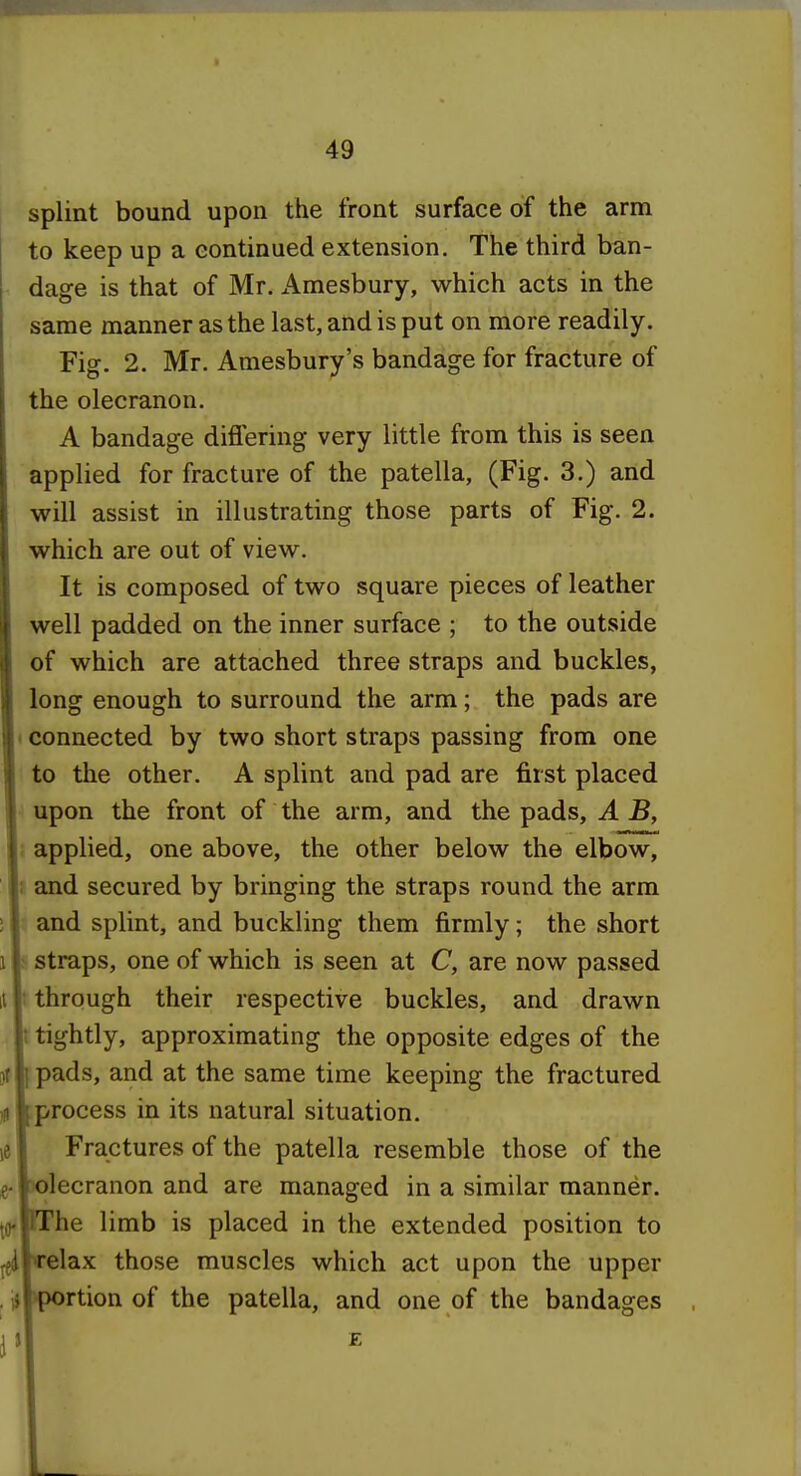 splint bound upon the front surface of the arm to keep up a continued extension. The third ban- dage is that of Mr. Amesbury, which acts in the same manner as the last, and is put on more readily. Fig. 2. Mr. Amesbury's bandage for fracture of the olecranon. A bandage difiering very little from this is seen applied for fracture of the patella, (Fig. 3.) and will assist in illustrating those parts of Fig. 2. which are out of view. It is composed of two square pieces of leather well padded on the inner surface ; to the outside of which are attached three straps and buckles, long enough to surround the arm; the pads are I connected by two short straps passing from one to the other. A splint and pad are first placed upon the front of the arm, and the pads, A B, i applied, one above, the other below the elbow, t and secured by bringing the straps round the arm and splint, and buckling them firmly; the short 1 ^ straps, one of which is seen at C, are now passed ii : through their respective buckles, and drawn t tightly, approximating the opposite edges of the }f I pads, and at the same time keeping the fractured ,9 process in its natural situation, le Fractures of the patella resemble those of the ^. x)lecranon and are managed in a similar manner, jfl. FThe limb is placed in the extended position to jfi relax those muscles which act upon the upper . ij >portion of the patella, and one of the bandages