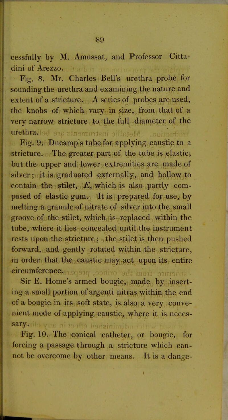 cessfully by M. Amussat, and Professor Citta- dini of Arezzo. Fig. 8. Mr. Charles Bell's urethra probe for sounding the urethra and examining the nature and extent of a stricture. A series of probes are used, the knobs of which vary in size, from that of a very narrow stricture to the full diameter of the urethra. Eig. 9. Ducamp's tube for applying caustic to a stricture. The greater part of the tube is elastic^ but the upper and lower extremities are made of silver it ^is graduated externally, and hollow to contain the stilet, E, which is also partly com- posed of elastic gum..; Jt is prepared for use, by melting a granule of nitrate of silver into the small groove of the stilet, which is replaced within the tube, where it lies concealed until the instrument rests upon the stricture; the stilet is then pushed forward, and gently rotated within the stricture, in order that the caustic may act upon its entire circumference. Sir E. Home's armed bougie, made by insert- ing a small portion of argenti nitras within the end of a bougie in its soft state, is also a very conve- nient mode of applying caustic, where it is neces- sary. Fig. 10. The conical catheter, or bougie, for forcing a passage through a stricture which can- not be overcome by other means. It is a dange-