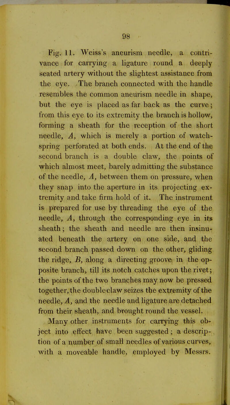 Fig. 11. Weiss's aneurism needle, a contri- vance for carrying a ligature round a deeply seated artery without the slightest assistance from the eye. The branch connected with the handle resembles the common aneurism needle in shape, but the eye is placed as far back as the curve; from this eye to its extremity the branch is hollow, forming a sheath for the reception of the short needle, A, which is merely a portion of watch- spring perforated at both ends. At the end of the second branch is a double claw, the points of which almost meet, barely admitting the substance of the needle. A, between them on pressure, when they snap into the aperture in its projecting ex- tremity and take firm hold of it. The instrument is prepared for use by threading the eye of the needle, .4, through the corresponding eye in its sheath; the sheath and needle are then insinu- ated beneath the artery on one side, and the second branch passed down on the other, gliding the ridge, jB, along a directing groove in the op- posite branch, till its notch catches upon the rivet; the points of the two branches may now be pressed together, the double claw seizes the extremity of the needle, A, and the needle and ligature are detached from their sheath, and brought round the vessel. Many other instruments for carrying this ob- ject into effect have been suggested; a descrip- tion of a number of small needles of various curves, with a moveable handle, employed by Messrs.