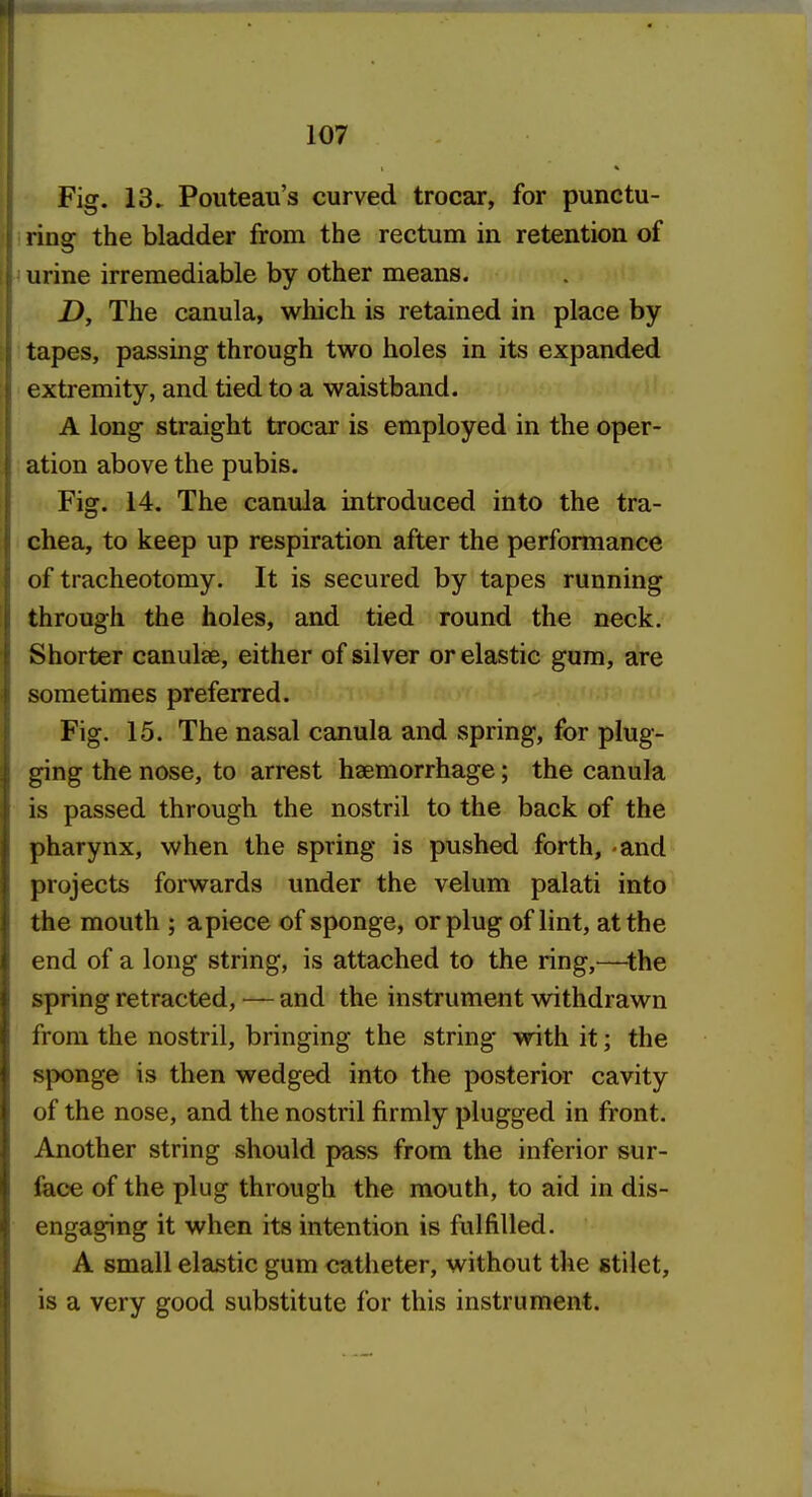 Fig. 13^ Pouteau's curved trocar, for punctu- ning- the bladder from the rectum in retention of murine irremediable by other means. D, The canula, wliich is retained in place by tapes, passing through two holes in its expanded extremity, and tied to a waistband. A long straight trocar is employed in the oper- ation above the pubis. Fig. 14. The canula introduced into the tra- I chea, to keep up respiration after the performance of tracheotomy. It is secured by tapes running through the holes, and tied round the neck. Shorter canulae, either of silver or elastic gum, are sometimes preferred. Fig. 15. The nasal canula and spring, for plug- ging the nose, to arrest haemorrhage; the canula is passed through the nostril to the back of the pharynx, when the spring is pushed forth, and projects forwards under the velum palati into the mouth ; apiece of sponge, or plug of lint, at the end of a long string, is attached to the ring,—^the spring retracted, — and the instrument withdrawn from the nostril, bringing the string vrith it; the sponge is then wedged into the posterior cavity of the nose, and the nostril firmly plugged in front. Another string should pass from the inferior sur- jCace of the plug through the mouth, to aid in dis- engaging it when its intention is fulfilled. A small elastic gum catheter, without the stilet, is a very good substitute for this instrument.