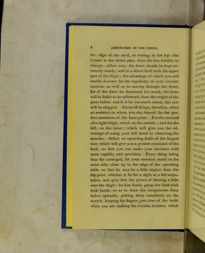 the edge of the stool, or resting in his lap: the former is the better plan, from the less liability to change: either way, the knee should be kept ex- tremely steady, and in a direct level with the upper part of the thigh ; the advantage of which you will readily discover by the regularity of your circular incision, as well as in sawing through the bone, for if the knee be depressed too much, the bone will be liable to be splintered, from the weight of the parts below, and if it be too much raised, the saw will be clogged. Above all things, therefore, select an assistant on whom you can depend for the per^ feet steadiness of the knee-joint. For the removal of a right thigh, stand on the outside ; and for the left, on the inner; which will give you the ad- vantage of using your left hand in retracting the muscles. Select an operating knife of the largest size, which will give you a greater command of the limb, so that you can make your incisions with more rapidity and precision. Every thing being thus far arranged, let your assistant stand on the outer side, close up to the edge of the operating table, so that he may be a little higher than the hip-joint, whether it be for a right or a left ampu- tation, and give him the power of leaning a little over the thigh : let him firmly grasp the limb with both hands, so as to draw the integuments from below upwards, putting them completely on the stretch, keeping his fingers just clear of the knife when you are making the circular incision, which