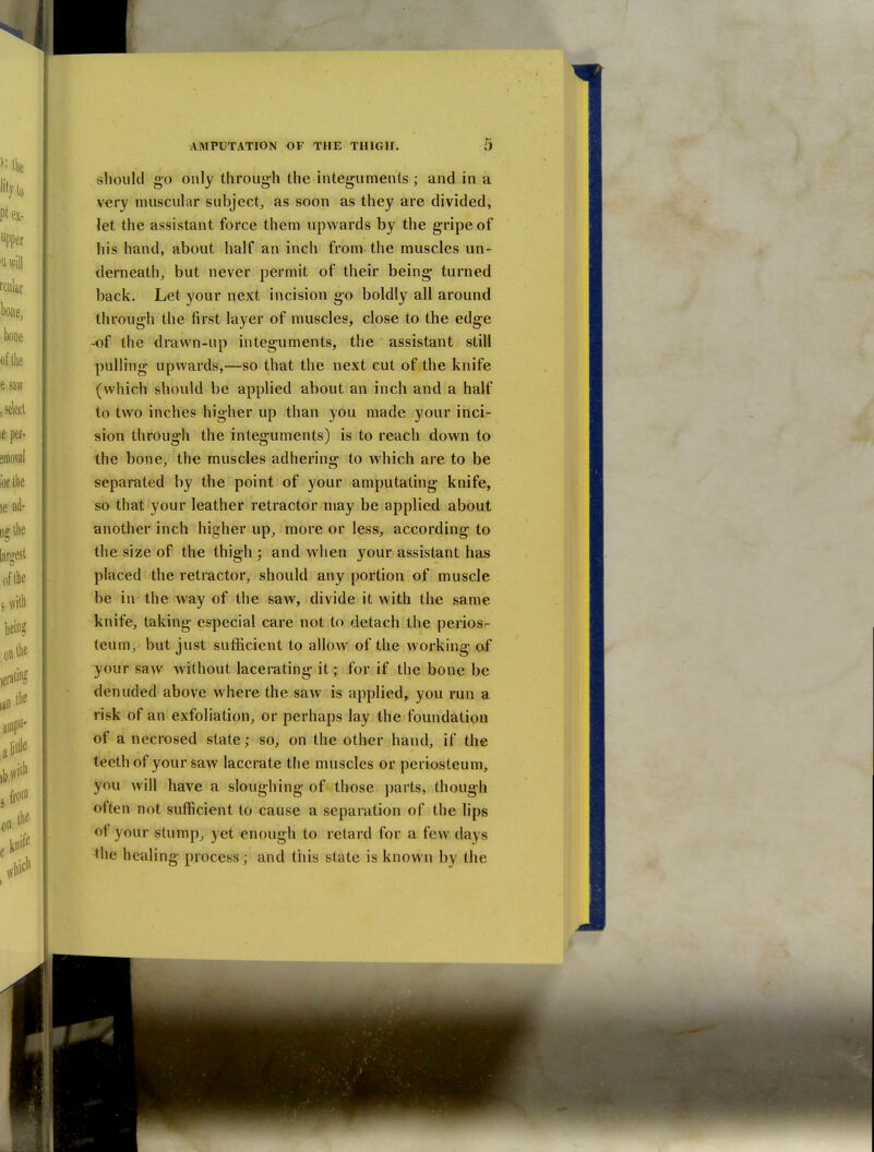 should go only through the integuments; and in a very muscular subject^ as soon as they are divided, let the assistant force them upwards by the gripe of his hand, about half an inch from the muscles un- derneath, but never permit of their being turned back. Let your next incision go boldly all around through the first layer of muscles, close to the edge -of the drawn-up integuments, the assistant still pulling upwards,—so that the next cut of the knife (which should be applied about an inch and a half to two inches higher up than you made your inci- sion through the integuments) is to reach down to the bone, the muscles adhering' to which are to be separated by the point of your amputating knife, so that your leather retractor may be applied about another inch higher up, more or less, according- to the size of the thigh ; and when your assistant has placed the retractor, should any portion of muscle be in the way of the saw, divide it with the same knife, taking especial care not to detach the perios- teum, but just sufficient to allow of the working of your saw without lacerating it ; for if the bone be denuded above where the saw is applied, you run a risk of an exfoliation, or perhaps lay the foundation of a necrosed state; so, on the other hand, if the teeth of your saw lacerate tlie muscles or periosteum, you will have a sloughing of those parts, though often not sufficient to cause a separation of the lips of your stump, yet enough to retard for a few days the healing process; and this state is known by the