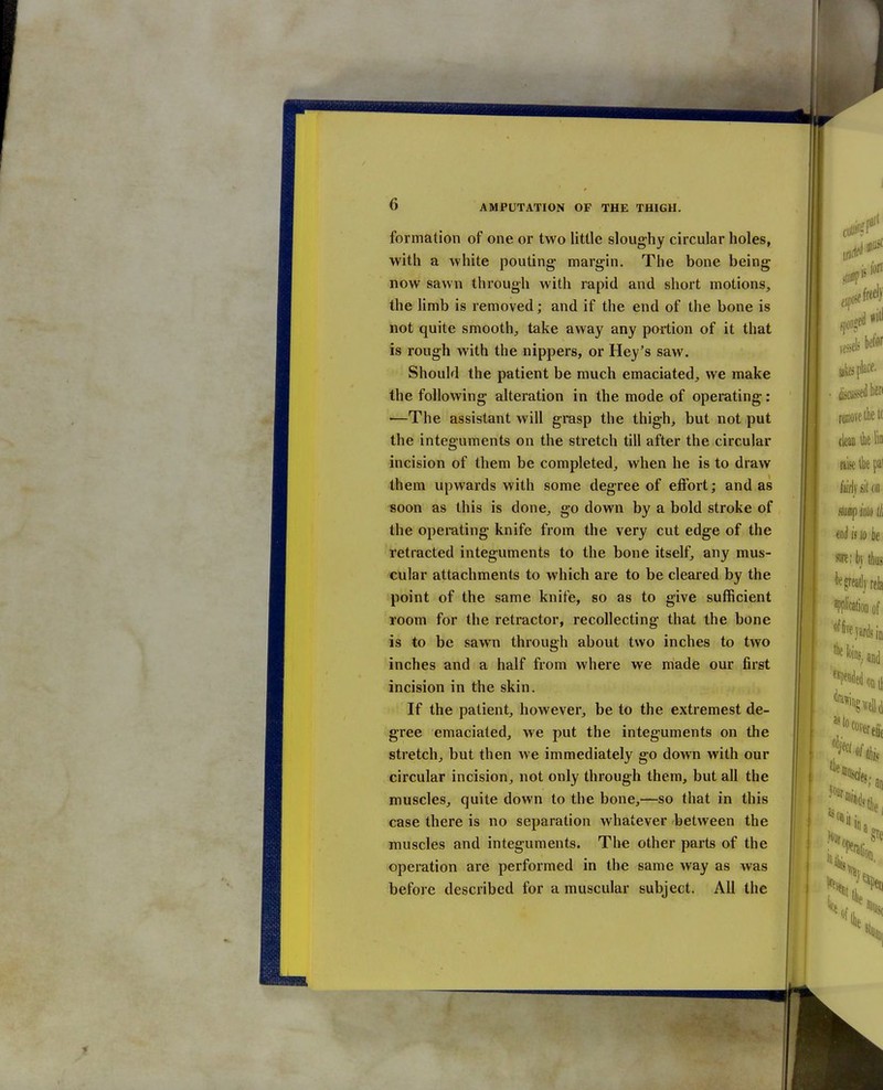 formation of one or two little sloughy circular holes, with a white pouting margin. The bone being now sawn through with rapid and short motions, the limb is removed; and if the end of the bone is not quite smooth^, take away any portion of it that is rough with the nippers, or Hey's saw. Should the patient be much emaciated, we make the following alteration in the mode of operating: ■—The assistant will grasp the thigh, but not put the integuments on the stretch till after the circular incision of them be completed, when he is to draw them upwards with some degree of effort; and as soon as this is done, go down by a bold stroke of the operating knife from the very cut edge of the retracted integuments to the bone itself, any mus- cular attachments to which are to be cleared by the point of the same knife, so as to give sufficient room for the retractor, recollecting that the bone is to be sawn through about two inches to two inches and a half from where we made our first incision in the skin. If the patient, however, be to the extremest de- gree emaciated, we put the integuments on the stretch, but then we immediately go down with our circular incision, not only through them, but all the muscles, quite down to the bone,—so that in this case there is no separation whatever between the muscles and integuments. The other parts of the operation are performed in the same way as was before described for a muscular subject. All the