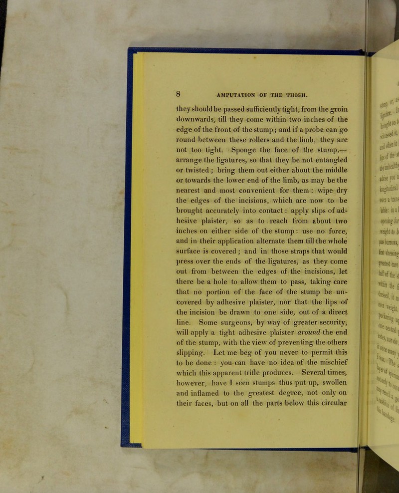 they should be passed sufficiently tight^ from the groin downwards, till they come within two inches of the edge of the front of the stump; and if a probe can go round between these rollers and the limb;, they are not too tight. Sponge the face of the stump,— arrange the ligatures, so that they be not entangled or twisted ; bring- them out either about the middle or towards the lower end of the limb, as may be the nearest and most convenient for them : wipe dry the edges of the incisions, which are now to be brought accurately into contact: apply slips of ad- hesive plaister, so as to reach from about two inches on either side of the stump: use no force, and in their application alternate them till the whole surface is covered; and in those straps that would press over the ends of the ligatures, as they come out from between the edges of the incisions, let there be a hole to allow them to pass, taking care that no portion of the face of the stump be un- covered by adhesive plaister, nor that the lips of the incision be drawn to one side, out of a direct line. Some surgeons, by way of greater security, will apply a tight adhesive plaister around the end of the stump, with the view of preventing the others slipping. Let me beg of you never to permit this to be done : you can have no idea of the mischief which this apparent trifle produces. Several times, however, have I seen stumps thus put up, swollen and inflamed to the greatest degree, not only on their faces, but on all the parts below this circular