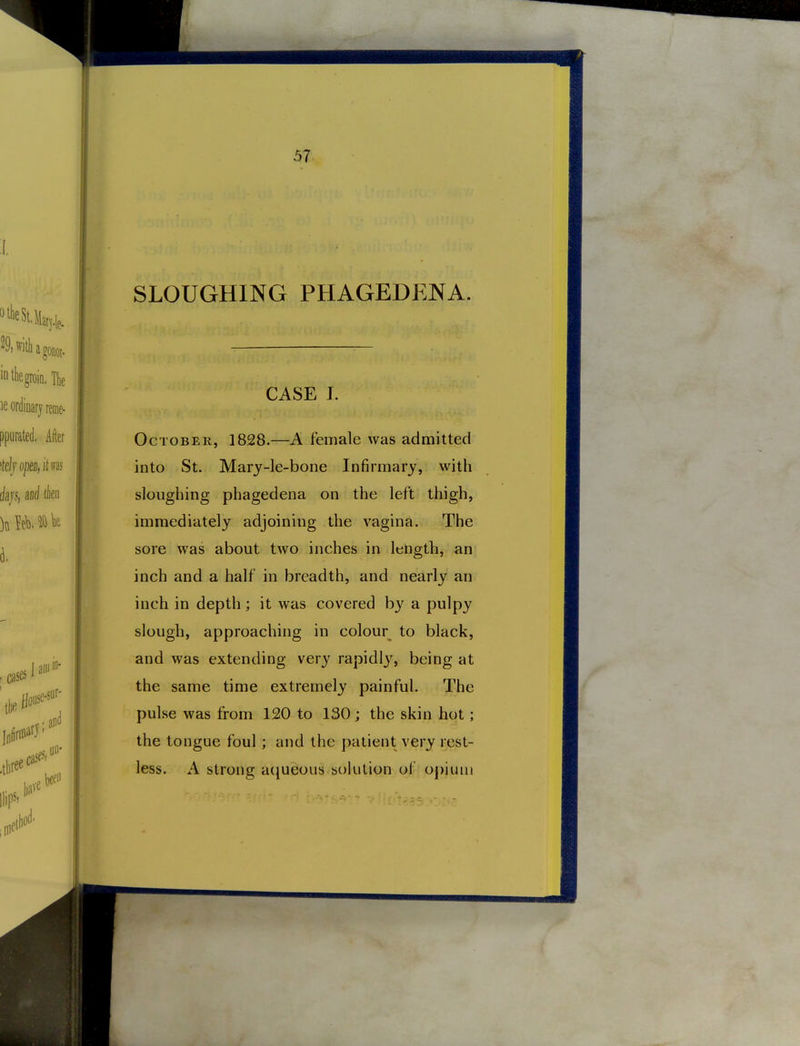 29.williagoEot. 'ntliegroiD.TIie le ordinary reme- ppurated. After idjoptSi'itni hjs, and tie i SLOUGHING PHAGEDENA. cases jaBi'' ,l,ree**- been CASE J. October, 1828.—A female was admitted into St. Marj-le-bone Infirmary, with sloughing phagedena on the left thigh, immediately adjoining the vagina. The sore was about two inches in length, an j;t inch and a half in breadth, and nearly an inch in depth; it was covered b}' a pulpy slough, approaching in colour to black, and was extending very rapidlj^ being at the same time extremely painful. The pulse was from 120 to 130; the skin hot; the tongue foul; and the patient very rest- less. A strong aqueous sokition of opium