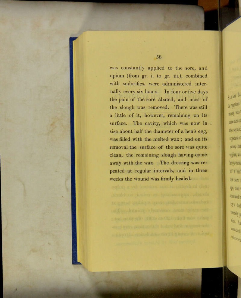 was constantly applied to the sore, and opium (from gr. i. to gr. iii.), combined with sudorifics, were administered inter- nally every six hours. In four or five days the pain of the sore abated, and most of the slough was removed. There was still a little of it, however, remaining on its surface. The cavity, which was now in ^ size about half the diameter of a hen's egg, was filled with the melted wax ; and on its removal the surface of the sore was quite clean, the remaining slough having come away with the wax. The dressing was re- peated at regular intervals, and in three weeks the wound was firmly healed.