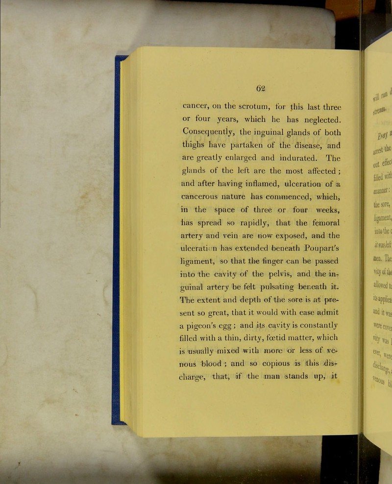 cancer, on the scrotum, for this last three or four years, which he has neglected. Consequently, the inguinal glands of both thighs have partaken of the disease, and are greatly enlarged and indurated. The glands of the left are the most affected ; and after having inflamed, ulceration of a cancerous nature has commenced, which, in the space of three or four weeks, has spread so rapidly, that the femoral artery and vein are now exposed, and the ulceration has extended beneath Poupart's ligament, so that the finger can be passed into the cavity of the pelvis, and the in- guinal artery be felt pulsating beneatli it. The extent and depth of the sore is at pre- sent so great, that it would with ease admit a pigeon's egg ; and its cavity is constantly filled with a thin, dirty, foetid matter, which is usually mixed with more or less of ve^ nous blood ; and so copious is this .disr- charge, that, if the man stands up, irt arrest out filled ujanDi llie ligam intot kns oien, vity alloii ilsap andi were vitj ever,