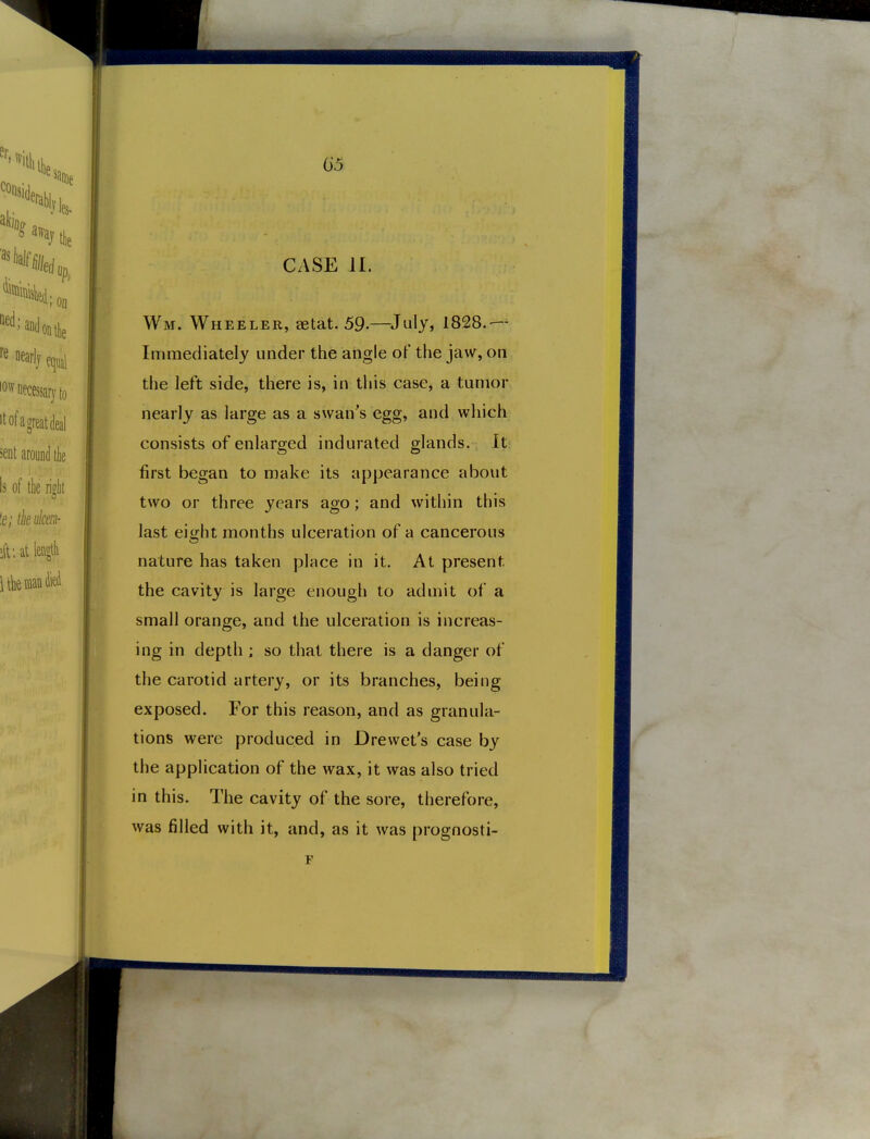 CASE 11. Wm. Wheeler, aetat. 59-—^July, 1828.— Immediately under the angle of the jaw, on the left side, there is, in this case, a tumor nearly as large as a swan's egg, and which consists of enlarged indurated glands. It first began to make its appearance about two or three years ago; and within this last eight months ulceration of a cancerous nature has taken place in it. At present the cavity is large enough to admit of a small orange, and the ulceration is increas- ing in depth ; so that there is a danger of the carotid artery, or its branches, being exposed. For this reason, and as granula- tions were produced in Drewet's case by the application of the wax, it was also tried in this. The cavity of the sore, therefore, was filled with it, and, as it was prognosti-