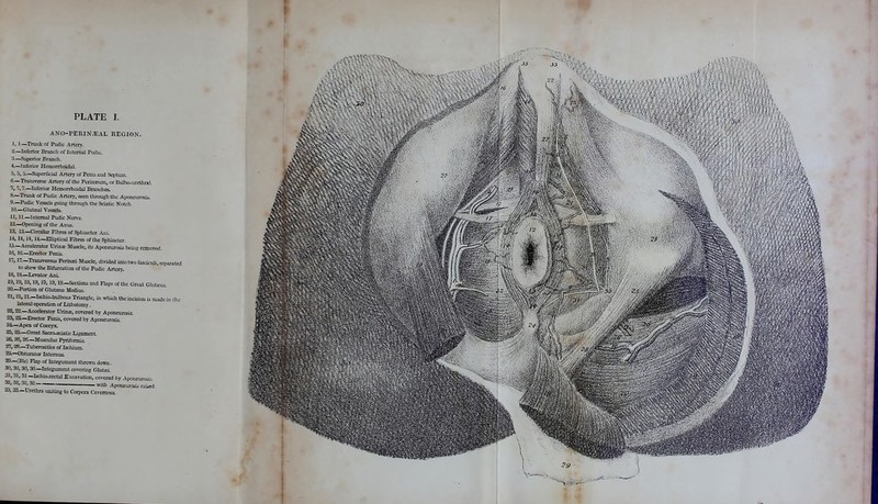 I PLATE I. ANO-PERIN'JEAL REGION. I, I.—Trunk of Pudic Artery. ——Inferior Branch of Interna] Pudic. 3—Superior Branch. 4. —Inferior Hemorrhoidal. 5, 5, 5—Superficial Artery of Penis and Septum. 6—Transverse Artery of the Perinsium, or Bulbo-urcthral. 7, 7,7.—Inferior Hemorrhoidal Branches. a—Trunk of Pudic Artery, seen through the Aponeurotic 9.—Pudic Vessels going through the Sciatic Notch. 10—Gluteal Vessels. II, 1L— Internal Pudic Nerve. 12—Opening of the Anus. 13, 13.—Circular Fibres of Sphincter Am. 14,14, II, 14—EQiptica] Fibres of the Sphincter. la—Accelerator Urinss Muscle, its Aponeurosis being removed. 16V 16—Erector Penis. 17,17.—Transversus Periruei Muscle, divided into two fasciculi, separated to shew the Bifurcation of the Pudic Artery. IS, la—Levator Ani 19,19,19,19, IB, 19, la-sections and Flap, of the Great Gluteus. 20.—Portion of Gluteus Medius. 21,21,21—Ischio-buJbous Triangle, in which the incision U made in ihe lateral operation of Lithotomy. 22.22— Accelerator Urins, covered by Aponeurosis 23.23— Erector Penis, covered by Aponeurosis. 24—Apex of Coccyx. 25,25—Great Sacra-sciatic Ligament 26, 36,26.—Musculus Pyriformis. 27,2a—Tuberosities of Ischium. 2a—Obturator Intern us. 29—(Bis) Flap of Integument thrown down. 30, 30,30,3a—Integument covering Glutei 31,31,31 -IsrJuo-rectal Excavation, covered by Aponeurosis. « ^ ^ Aponeuroai raised. *J> 33—Urethra uniting to Corpora Cavernosa.