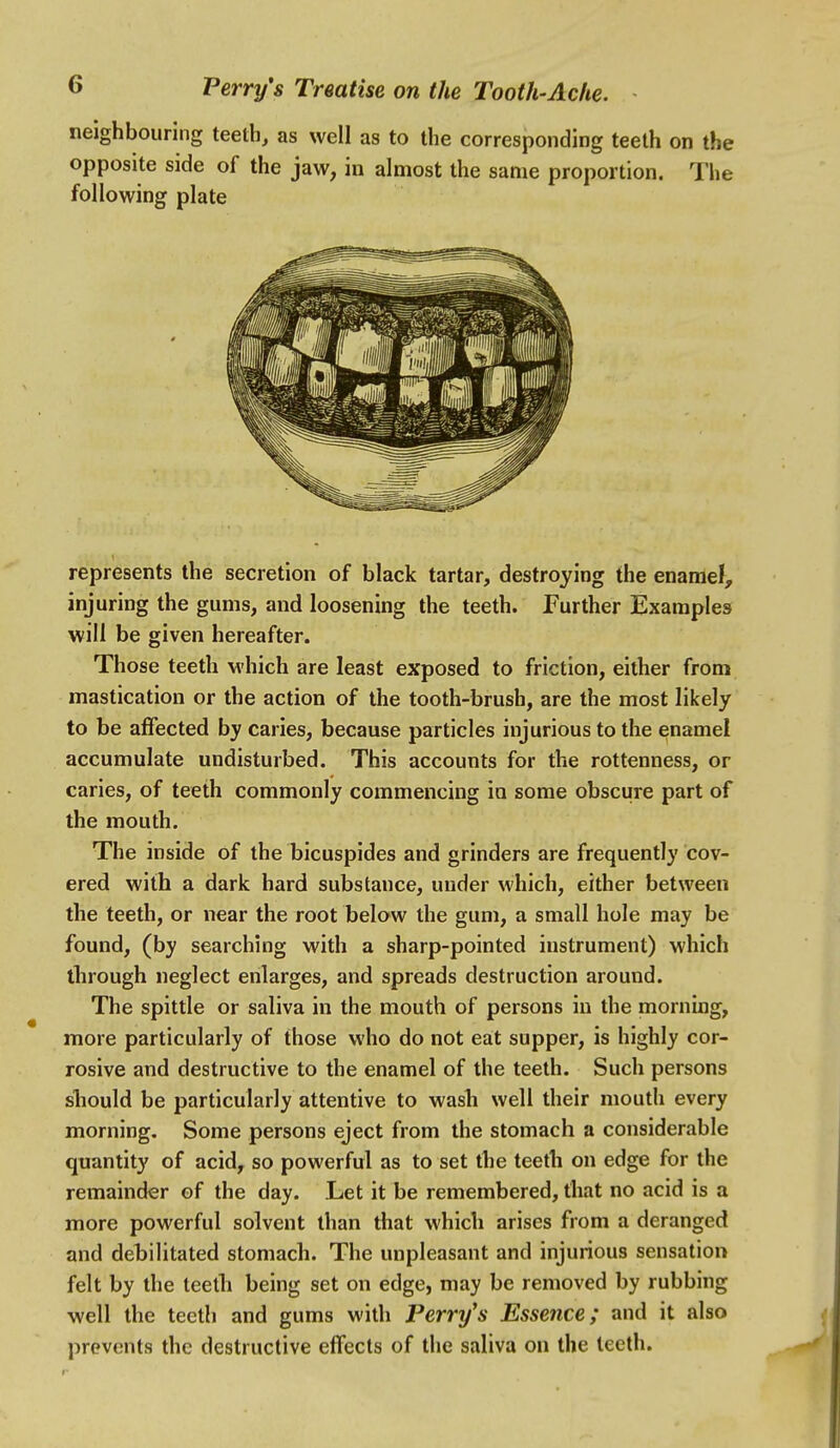 neighbouring teeth, as well as to the corresponding teeth on the opposite side of the jaw, in almost the same proportion. The following plate represents the secretion of black tartar, destroying the enamel, injuring the gums, and loosening the teeth. Further Examples will be given hereafter. Those teeth which are least exposed to friction, either from mastication or the action of the tooth-brush, are the most likely to be aflfected by caries, because particles injurious to the enamel accumulate undisturbed. This accounts for the rottenness, or caries, of teeth commonly commencing in some obscure part of the mouth. The inside of the bicuspides and grinders are frequently cov- ered with a dark hard substance, under which, either between the teeth, or near the root below the gum, a small hole may be found, (by searching with a sharp-pointed instrument) which through neglect enlarges, and spreads destruction around. The spittle or saliva in the mouth of persons in the morning, more particularly of those who do not eat supper, is highly cor- rosive and destructive to the enamel of the teeth. Such persons should be particularly attentive to wash well their mouth every morning. Some persons eject from the stomach a considerable quantity of acid, so powerful as to set the teeth on edge for the remainder of the day. Let it be remembered, that no acid is a more powerful solvent than that which arises from a deranged and debilitated stomach. The unpleasant and injurious sensation felt by the teeth being set on edge, may be removed by rubbing well the teeth and gums with Perry's Essence; and it also prevents the destructive effects of the saliva on the teeth.