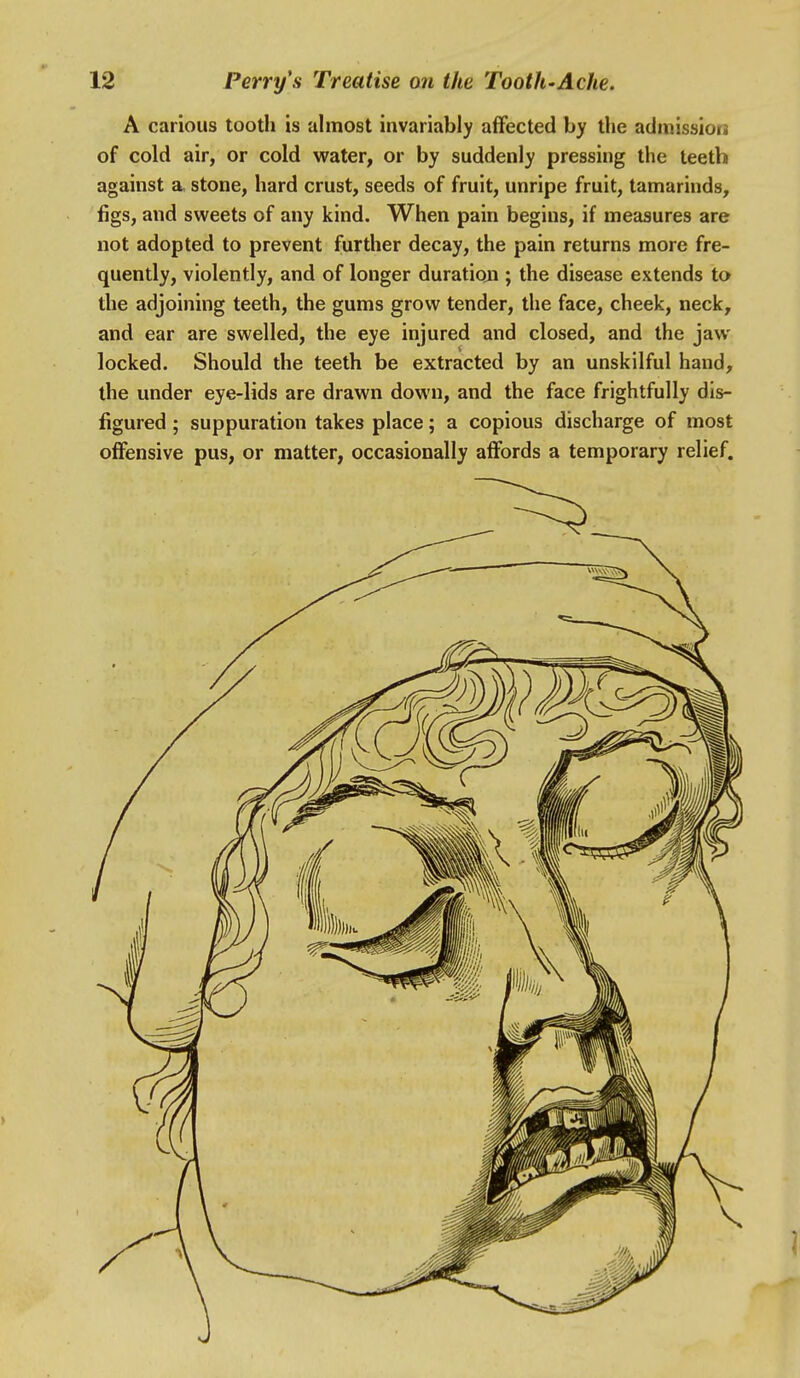 A carious tooth is almost invariably affected by the admission of cold air, or cold water, or by suddenly pressing the teeth against a, stone, hard crust, seeds of fruit, unripe fruit, tamarinds, figs, and sweets of any kind. When pain begins, if measures are not adopted to prevent further decay, the pain returns more fre- quently, violently, and of longer duration ; the disease extends to the adjoining teeth, the gums grow tender, the face, cheek, neck, and ear are swelled, the eye injured and closed, and the jaw- locked. Should the teeth be extracted by an unskilful hand, the under eye-lids are drawn down, and the face frightfully dis- figured ; suppuration takes place; a copious discharge of most offensive pus, or matter, occasionally affords a temporary relief.