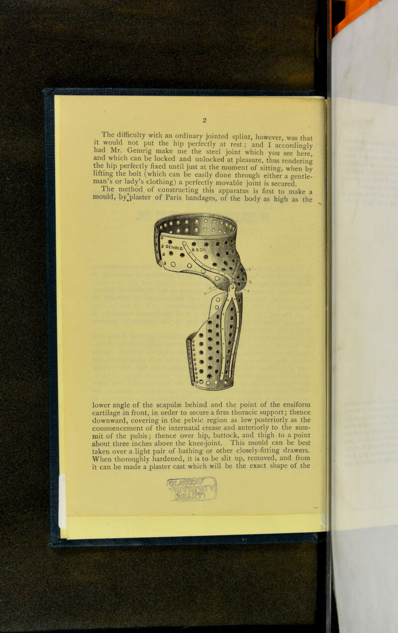 The difficulty with an ordinary jointed splint, however, was that It would not put the hip perfectly at rest ; and I accordingly had Mr. Gemng make me the steel joint which you see here and which can be locked and unlocked at pleasure, thus rendering the hip perfectly fixed until just at. the moment of sitting, when by lifting the bolt (which can be easily done through either a gentle- man's or lady's clothing) a perfectly movable joint is secured. The method of constructing this apparatus is first to make a mould, by^plaster of Paris bandages, of the body as high as the lower angle of the scapulse behind and the point of the ensiform cartilage in front, in order to secure a firm thoracic support; thence downward, covering in the pelvic region as low posteriorly as the commencement of the internatal crease and anteriorly to the sum- mit of the pubis; thence over hip, buttock, and thigh to a point about three inches above the knee-joint. This mould can be best taken over a light pair of bathing or other closely-fitting drawers. When thoroughly hardened, it is to be slit up, removed, and from it can be made a plaster cast which will be the exact shape of the