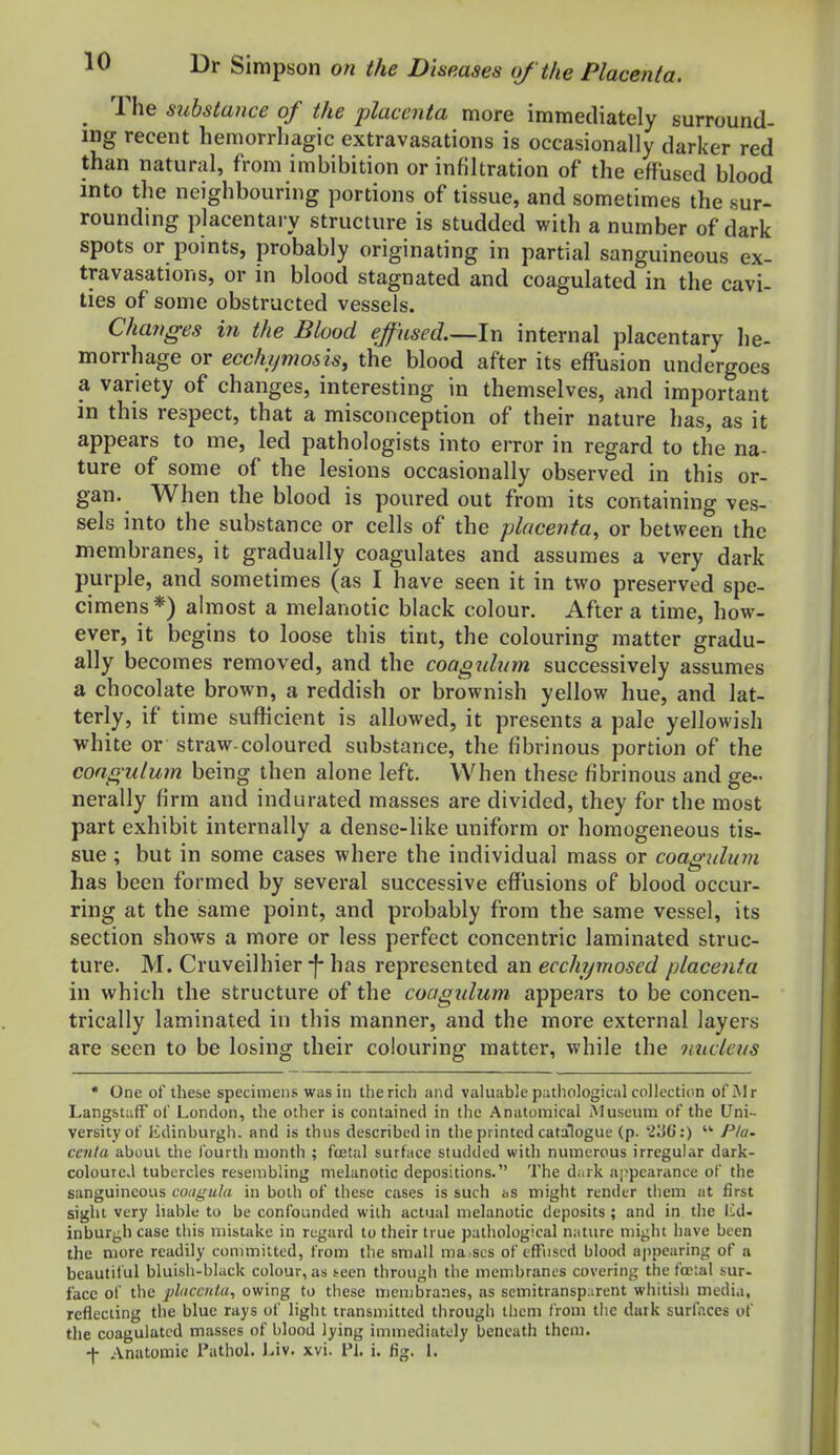 ^ The substance of the placenta more immediately surround- ing recent hemorrhagic extravasations is occasionally darker red than natural, from imbibition or infiltration of the effused blood into the neighbouring portions of tissue, and sometimes the sur- rounding placentary structure is studded with a number of dark spots or points, probably originating in partial sanguineous ex- travasations, or in blood stagnated and coagulated in the cavi- ties of some obstructed vessels. Changes in the Blood efused.—In internal placentary lie- morrhage or ecchymosis, the blood after its effusion undergoes a variety of changes, interesting in themselves, and important in this respect, that a misconception of their nature has, as it appears to me, led pathologists into error in regard to the na- ture of some of the lesions occasionally observed in this or- gan. When the blood is poured out from its containing ves- sels into the substance or cells of the placenta, or between the membranes, it gradually coagulates and assumes a very dark purple, and sometimes (as I have seen it in two preserved spe- cimens*) almost a melanotic black colour. After a time, how- ever, it begins to loose this tint, the colouring matter gradu- ally becomes removed, and the coagnhnn successively assumes a chocolate brown, a reddish or brownish yellow hue, and lat- terly, if time sufficient is allowed, it presents a pale yellowish white or straw-coloured substance, the fibrinous portion of the congidum being then alone left. When these fibrinous and ge- nerally firm and indurated masses are divided, they for the most part exhibit internally a dense-like uniform or homogeneous tis- sue ; but in some cases where the individual mass or coaguluni has been formed by several successive effusions of blood occur- ring at the same point, and probably from the same vessel, its section shows a more or less perfect concentric laminated struc- ture. M. Cruveilhier-f- has represented an ecchymosed placenta in which the structure of the coagidum appears to be concen- trically laminated in this manner, and the more external layers are seen to be losing their colouring matter, while the micleus * One of these specimens was in the rich and valuable pathological collection ofi\lr LangstafF of London, the other is contained in the Anatomical Museum of the Uni- versity of lidinburgh. and is thus described in the printed catalogue (p. 236':)  Pla. cenla about the I'ourth month ; ftetal surface studded with numerous irregular dark- colourcvl tubercles resembling melanotic depositions. The dark ajjpearance of the sanguineous coagula in both of these cases is such hs might render them at first sight very liable to be confounded with actual melanotic deposits ; and in the lid- inburj^h case tiiis mistake in regard to their true pathological nature might have been the more readily committed, from the small ma scs of eff'uscd blood ajipearing of a beautiful bluish-black colour, as teen through the membranes covering the foc:al sur- face of the pliiccnta, owing to these membranes, as semitransp:irent whitish media, reflecting the blue rays of light transmitted through them from the dark surfaces of the coagulated masses of blood lying immediately beneath them. ■|- Anatomic Pathol, l^iv. xvi. Pi. i. fig. 1.