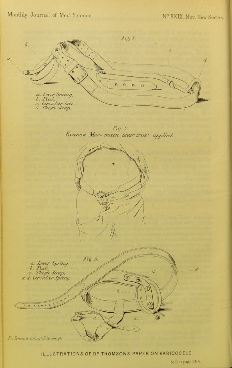 Monthly Journad of Med.Science N°XXIX, Nov. New Se: ILLUSTRATIONS OF D« THOMSON'S PAPER ON VARICOCELE. lofkce page 29,'i.