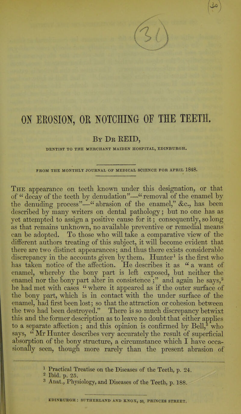 ON EROSION, OR NOTCHING OF THE TEETH. Bt De EEID, DENTIST TO THE MERCHANT MAIDEN HOSPITAL, EDINBURGH. FROM THE MONTHLY JOURNAL OF MEDICAL SCIENCE FOR APRIL 1848. The appearance on teeth known under this designation, or that of  decay of the teeth by denudation—removal of the enamel by the denuding process— abrasion of the enamel, &c., has been described by many writers on dental pathology; but no one has as yet attempted to assign a positive cause for it; consequently, so long as that remains imknown, no available preventive or remedial means can be adopted. To those who wiU take a comparative view of the different authors treating of this subject, it will become evident that there are two distinct appearances; and thus there exists considerable discrepancy in the accounts given by them. Hunter^ is the first who has taken notice of the affection. He describes it as  a want of enamel, whereby the bony part is left exposed, but neither the enamel nor the bony part alter in consistence ; and again he says,^ he had met with cases  where it appeared as if the outer surface of the bony part, which is in contact with the under surface of the enamel, had first been lost; so that the attraction or cohesion between tlie two had been destroyed. There is so much discrepancy betwixt this and the former description as to leave no doubt that either applies to a separate affection; and this opinion Is confirmed by Bell,^ who says,  Mr Hunter describes very accurately the result of superficial absorption of the bony structure, a circumstance which I have occa- sionally seen, though more rarely than the present abrasion of 1 Practical Treatise on the Diseases of the Teeth, p. 24. 2 Ibid. p. 25. 3 Anat., Physiology, and Diseases of the Teeth, p. 188. EDINBURGH : SUTHERLAND AND KNOX, 58, PRINCES STREET.