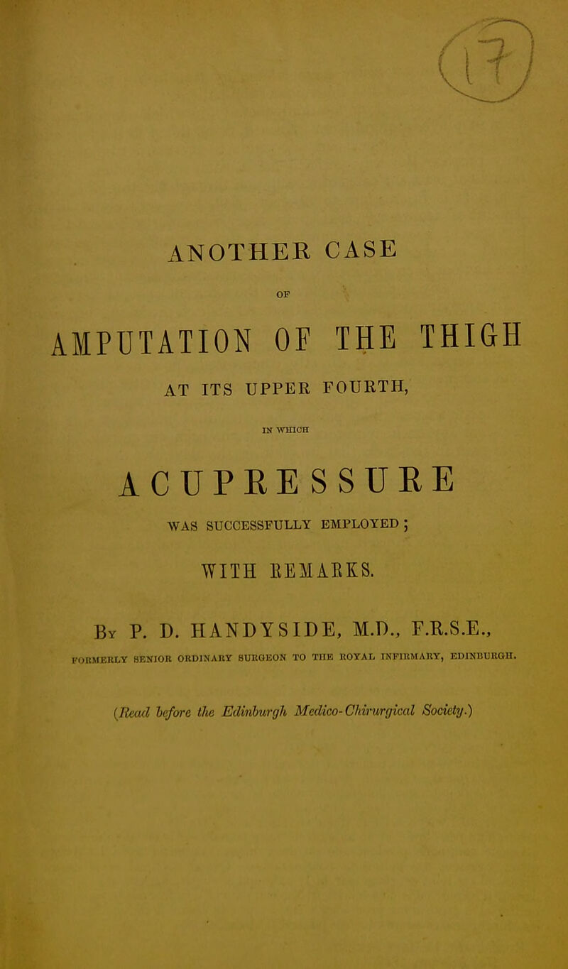 ANOTHER CASE OP AMPUTATION OF THE THIGH AT ITS UPPER FOURTH, IN WHICH ACUPRESSURE WAS SUCCESSFULLY EMPLOYED; WITH REMARKS. By P. D. HANDYSIDE, M.D., F.R.S.E., FORMERLY SENIOR ORDINARY SURGEON TO THE ROYAL INFIRMARY, EDINBURGH. (Read before tlie Edinburgh Medico- Chirurgical Society.)