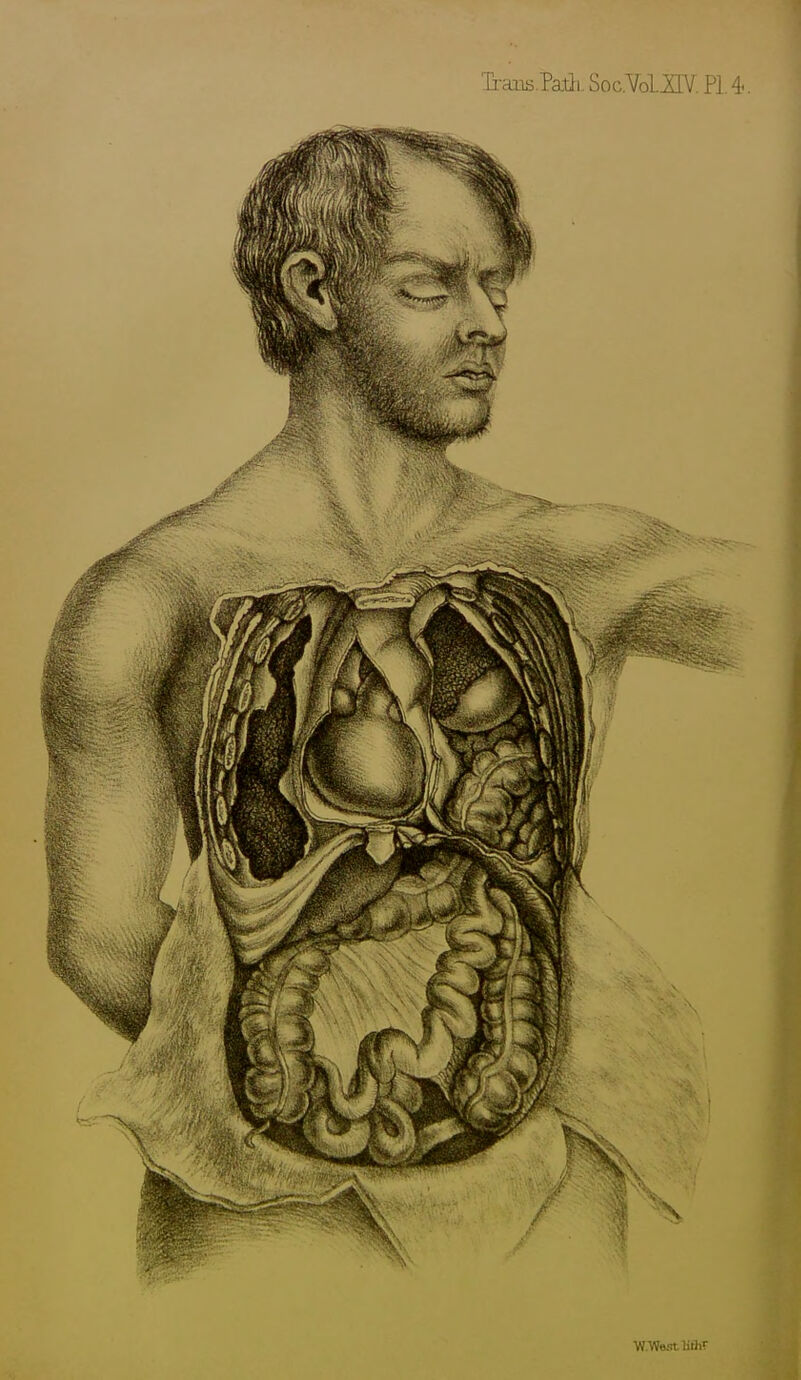 Ii-ausPatli. Soc.mUV. PI. 4. VJ.We.'n.lith'