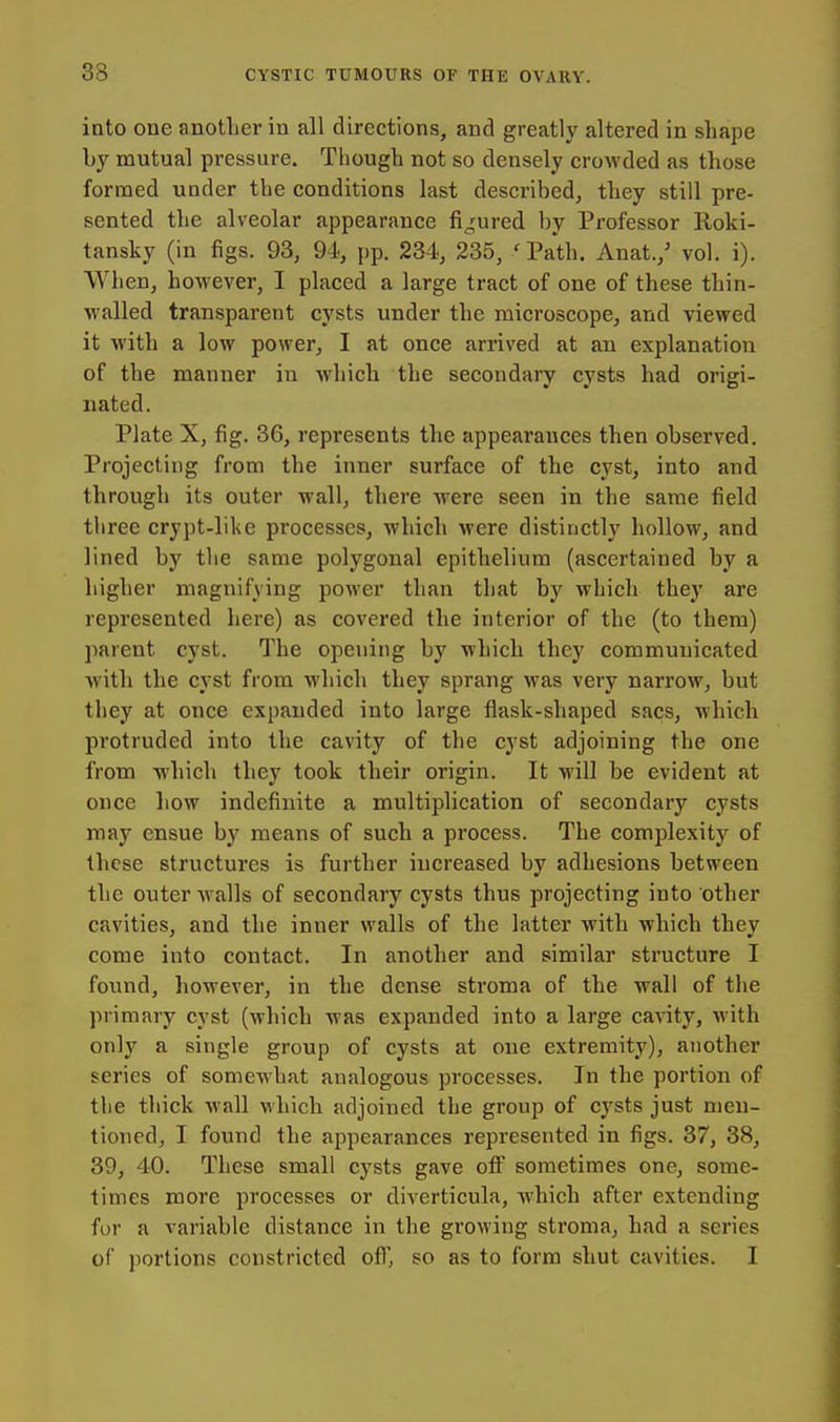 into one anotlier in all directions, and greatly altered in shape by mutual pressure. Tiiough not so densely crowded as those formed under the conditions last described, they still pre- sented the alveolar appearance figured by Professor Roki- tansky (in figs. 93, 94, pp. 234, 235, ' Path. Anat.,' vol. i). When, however, I placed a large tract of one of these thin- walled transparent cysts under the microscope, and viewed it with a low power, I at once arrived at an explanation of the manner in which the secondary cysts had origi- nated. Plate X, fig. 36, represents the appearances then observed. Projecting from the inner surface of the cyst, into and through its outer wall, there were seen in the same field three crypt-like processes, which were distinctly hollow, and lined by the same polygonal epithelium (ascertained by a higher magnifying power than that by which they are represented here) as covered the interior of the (to them) parent cyst. The opening by which they communicated with the cyst from which they sprang was very narrow, but they at once expanded into large flask-shaped sacs, which protruded into the cavity of the cyst adjoining the one from which they took their origin. It will be evident at once how indefinite a multiplication of secondary cysts may ensue by means of such a process. The complexity of these structures is further increased by adhesions between the outer walls of secondary cysts thus projecting into other cavities, and the inner walls of the latter with which they come into contact. In another and similar structure I found, however, in the dense sti'oma of the wall of the primary cyst (which was expanded into a large cavity, with only a single group of cysts at one extremity), another series of somewhat analogous processes. In the portion of the thick wall which adjoined the group of cysts just men- tioned, I found the appearances represented in figs. 37, 38, 39, 40. These small cysts gave off sometimes one, some- times more processes or diverticula, which after extending for a variable distance in the growing stroma, had a series of jjortions constricted ofl', so as to form shut cavities. I