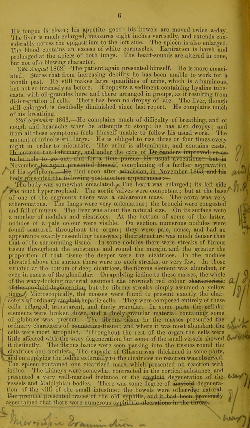 1-Iis tongue is clean; his appetite goorl; his bowels are moved twice a-day. Tiie liver is much enlarged, me.isures eight inches vertically, and extends con- siderably across the epigastrium to the left side. The spleen is also enlarged. The blood contains an excess of white corpuscles. Expiration is harsh and prolonged at the apices of both lungs. The heart-sounds are altered in tone, but not of a blowing character. 13th August 1862.—The patient again presented himself. He is more emaci- ated. States that from increasing debility he has been unable to work for a month past. He still makes large quantities of urine, which is albuminous, but not so intensely as before. It deposits a sediment containing hyaline tube- casts, with oil-granules here and there arranged in groups, as if resulting from disintegration of cells. There has been no dropsy of late. The liver, though still enlarged, is decidedly diminished since last report. He complains much of his breathing. 22d September 1863.—He complams much of difficulty of breathing, and ot cough and headache when he attempts to stoop; he has also dropsy; and from all these symptoms feels himself unable to follow his usual work. The amount of urine is still large. He is obliged to rise three or four times every night in order to micturate. The urine is albuminous, and contains casts. , ijp pntaKaa-tl.in-Inilrma.ry, and under the care of 1^ Sauders improvedi-BO m» , tn lie ithin tn gft mtt-,-n-n^-fr a -time pnrsue his Ttsnat 'avoratioTre7~bH*-i« t . November^« again-preswited hwmelf, complaining of a further aggravation /^of his syfi^oms—4+e died soon after admisaiou,,in .November 186<i, and-4ri6 ^k4^| b(>dyj?resented the following post-mortem appearances:— The body was somewhat emaciated.^Thc heart was enlarged; its left side tt^ ^ i'was much hypertrophied. The aortic valves were competent; but at the base/''• / of one of tlie segments there was a calcareous mass. The aorta was very atheromatous. The lungs were vciy ccderaatous; the bronchi were congested and full of mucus. The liver was about the natural size. On its surface were a number of nodules and cicatrices. At the bottom of some of the latter, nodules of a pale colour were visible. On section, numerous nodules were fouud scattered throughout the organ; they were pale, dense, and had an appearance exactly resembling bees-wax ; their structure was much denser than that of the surrounding tissue. In some nodules there were streaks of fibrous tissue throughout the substance and round the margin, and the greater the proportion of that tissue the deeper were the cicatrices. In the nodules elevated above the surface there were no such streaks, or very few. In those situated at the bottom of deep cicatrices, the fibrous element was abundant, or even in excess of the glandular. On applying iodine to these masses, the whole of the waxy-looking material assumed tlie brownish red colour oliaraotopietic of the-ftm-34oiLd-d-eg«ue]atam), but the fibrous streaks simply assumed a yellow tinggy Microscopically, the masses were found to present exactly the char- rmeters\jf ordmarj' aiimlBi4hepatic cells. They were composed entirely of these ' cells, erflarged, transparent, and finely granular. In some parts the cellular elements Were broken down, and a finely granular material containing some oil-globules was present. The fibrous tissue m the masses presented the J ' ordinary characters of oonncctl^-tissue; and where it was most abundant the cells were most atrophied. Throughout the rest of the organ the cells were little affected with the waxy degeneration, but some of the small vessels showed Ov^ ■ it distinctly. The fibrous bands were seen passing into the tissues round the %^ cicatrices and nodules.^^ The capsule of Glisson was thickened in some parts, \iind on applying the iodine externally to the cicatrices no reaction was observed. T*lie spleen contained one cicatrized mass, which presented no reaction with iodine. The kidneys were somewhat contracted in the cortical substance, and presented a very well-marked instance of the 'ny'''^ degeneration of the t^A^VV vessels and Malpighiaii bodies. Tliere was some degree of imiytoid degenera- /j tion of the villi of the small intestine; the bowels were otherwUc natural. ,-. 'Irke-prcpuce presented traces of the old syphilis, and it .had been previously •' ascertained that there were numerous^sjji)luliiiiwjl«ei«it4<me-hi-+h«-thTTm^ * /