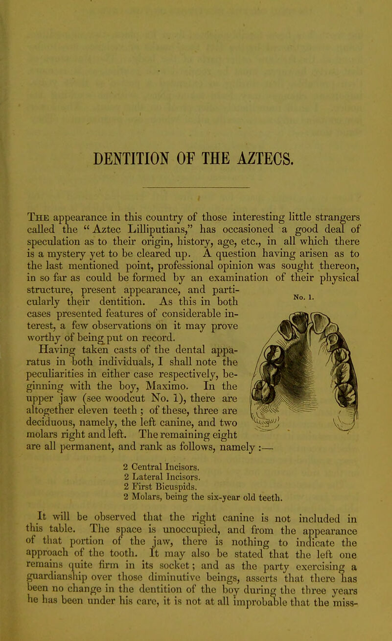 DENTITION OF THE AZTECS. Tele appearance in this country of those interesting little strangers called the  Aztec Lilliputians, has occasioned a good deal of speculation as to their origin, history, age, etc., in all which there is a mystery yet to be cleared up. A question having arisen as to the last mentioned point, professional opinion was sought thereon, in so far as could be formed by an examination of their physical structure, present appearance, and parti- cularly their dentition. As this in both ' cases presented featm'es of considerable in- terest, a few observations on it may prove worthy of being^put on record. Having taken casts of the dental appa- ratus in both individuals, I shall note the peculiarities in either case respectively, be- ginning with the boy, Maximo. In the upper jaw (see woodcut No. 1), there ai*e altogether eleven teeth ; of these, three are deciduous, namely, the left canine, and two molars right and left. The remaining eight are all permanent, and rank as follows, namely :— 2 Central Incisors. 2 Lateral Incisors. 2 First Bicuspids. 2 Molars, being the six-year old teeth. It will be observed that the right canine is not included in this table. The space is unoccupied, and from the appearance of that portion of the jaw, there is nothing to indicate the approach of the tooth. It may also be stated' that the left one remains quite firm in its socket; and as the party exercising a guardianship over those diminutive beings, asserts that there has been no change in the dentition of the boy during the three years he has been under his care, it is not at all improbable that the miss-