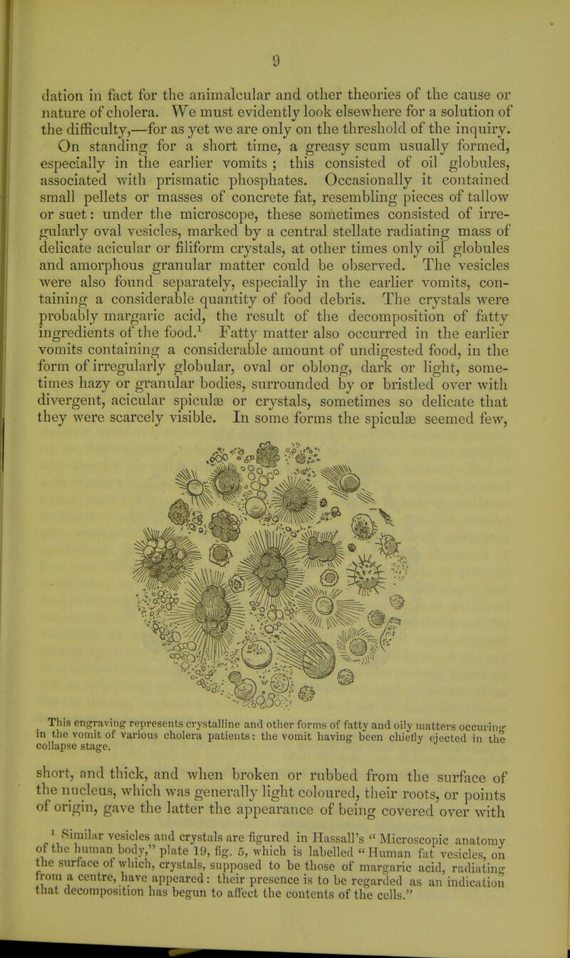 dation in fact for the animalcular and otlier theories of the cause or nature of cholera. We must evidently look elsewhere for a solution of the difficulty,—for as yet we are only ou the threshold of the inquiry. On standing for a short time, a greasy scum usually formed, especially in the earlier vomits ; this consisted of oil globules, associated v/ith prismatic phosphates. Occasionally it contained small pellets or masses of concrete fat, resembling pieces of tallow or suet: under the microscope, these sometimes consisted of irre- gularly oval vesicles, marked by a central stellate radiating mass of delicate acicular or filiform crystals, at other times only oil globules and amorphous granular matter could be observed. The vesicles were also found separately, especially in the earlier vomits, con- taining a considerable quantity of food debris. The crystals were probal3ly margaric acid, the result of the decomposition of ftitty ingredients of the food.^ Fatty matter also occurred in the earlier vomits containing a considerable amount of undigested food, in the form of irregularly globular, oval or oblong, dark or light, some- times hazy or granular bodies, surrounded by or bristled over with divergent, acicular spiculas or crystals, sometimes so delicate that they were scarcely visible. In some forms the spicules seemed few, This engraving represents crystalline and other forms of fatty and oily matters occiu in- in the vomit of various cholera patients: the vomit having been chiefly ejected in the collapse stage. short, and thick, and when broken or rubbed from the surface of the nucleus, which was generally light coloured, their roots, or points of origin, gave the latter the appearance of being covered over with 1 Similar vesicles and crystals are figured in Hassall's  Microscopic anatomy of the human body, plate 19, fig. 5, which is labelled Human fat vesicles, on the surface of which, crystals, supposed to be those of maro-aric acid, radiatin- from a centre, have appeared: their presence is to be regarded as an indication that decomposition has begun to aftect the contents of the cells.