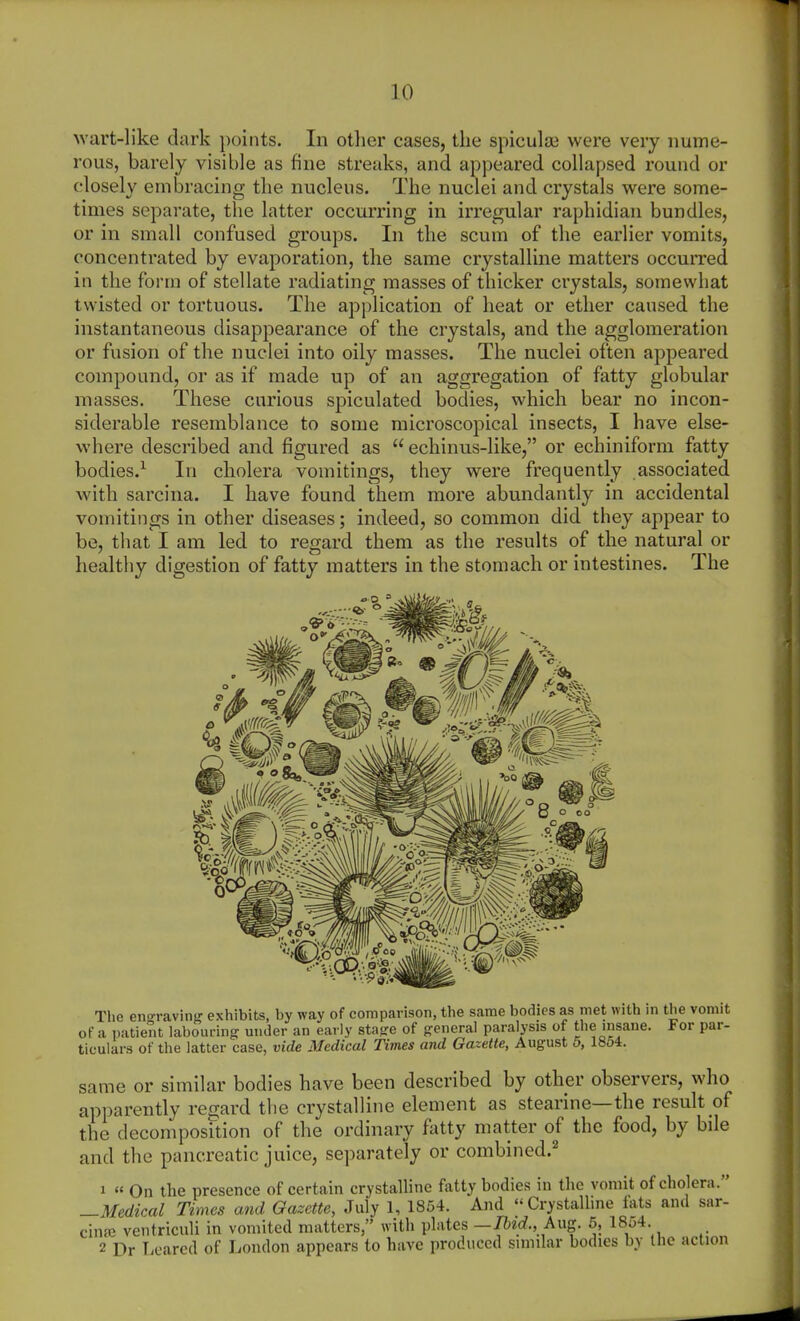 wart-like dark points. In otlier cases, the spiculai were very nume- rous, barely visible as fine streaks, and appeared collapsed round or closely embracing the nucleus. The nuclei and crystals were some- times separate, the latter occurring in irregular raphidian bundles, or in small confused groups. In the scum of the earlier vomits, concentrated by evaporation, the same crystalline matters occuiTed in the form of stellate radiating masses of thicker crystals, somewhat twisted or tortuous. The application of heat or ether caused the instantaneous disappearance of the crystals, and the agglomeration or fusion of the nuclei into oily masses. The nuclei often appeared compound, or as if made up of an aggregation of fatty globular masses. These curious spiculated bodies, which bear no incon- siderable resemblance to some microscopical insects, I have else- where described and figured as echinus-like, or echiniform fatty bodies.^ In cholera vomitings, they were frequently associated with sarcina. I have found them more abundantly in accidental vomitings in other diseases; indeed, so common did they appear to be, that I am led to regard them as the results of the natural or healthy digestion of fatty matters in the stomach or intestines. The The engravinf? exhibits, by way of comparison, the same bodies as met with m the vomit of a patient labouring^ under an early stagre of {general paralysis of the insane. For par- ticulars of the latter case, vide Medical Times and Gazette, August 5, 18o4. same or similar bodies have been described by other observers, who apparently regard tlie crystalline element as stearine—the result of the decomposition of the ordinary fatty matter of the food, by bile and the pancreatic juice, separately or combined.'' cinre 2 Dr Lcared of London appears to have produced similar bodies hy the action